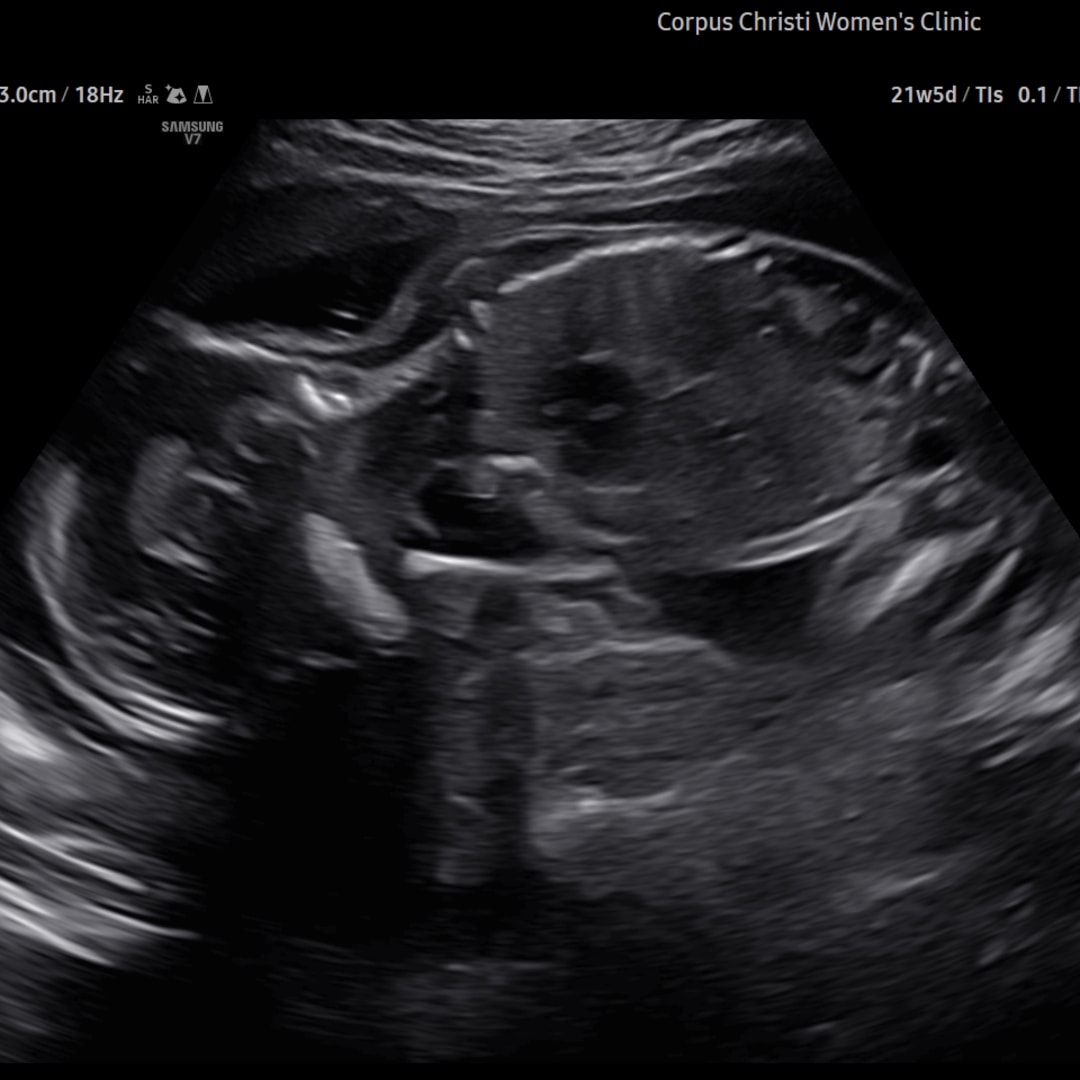 Photo shared by Alyssa for their Babylist baby registry.