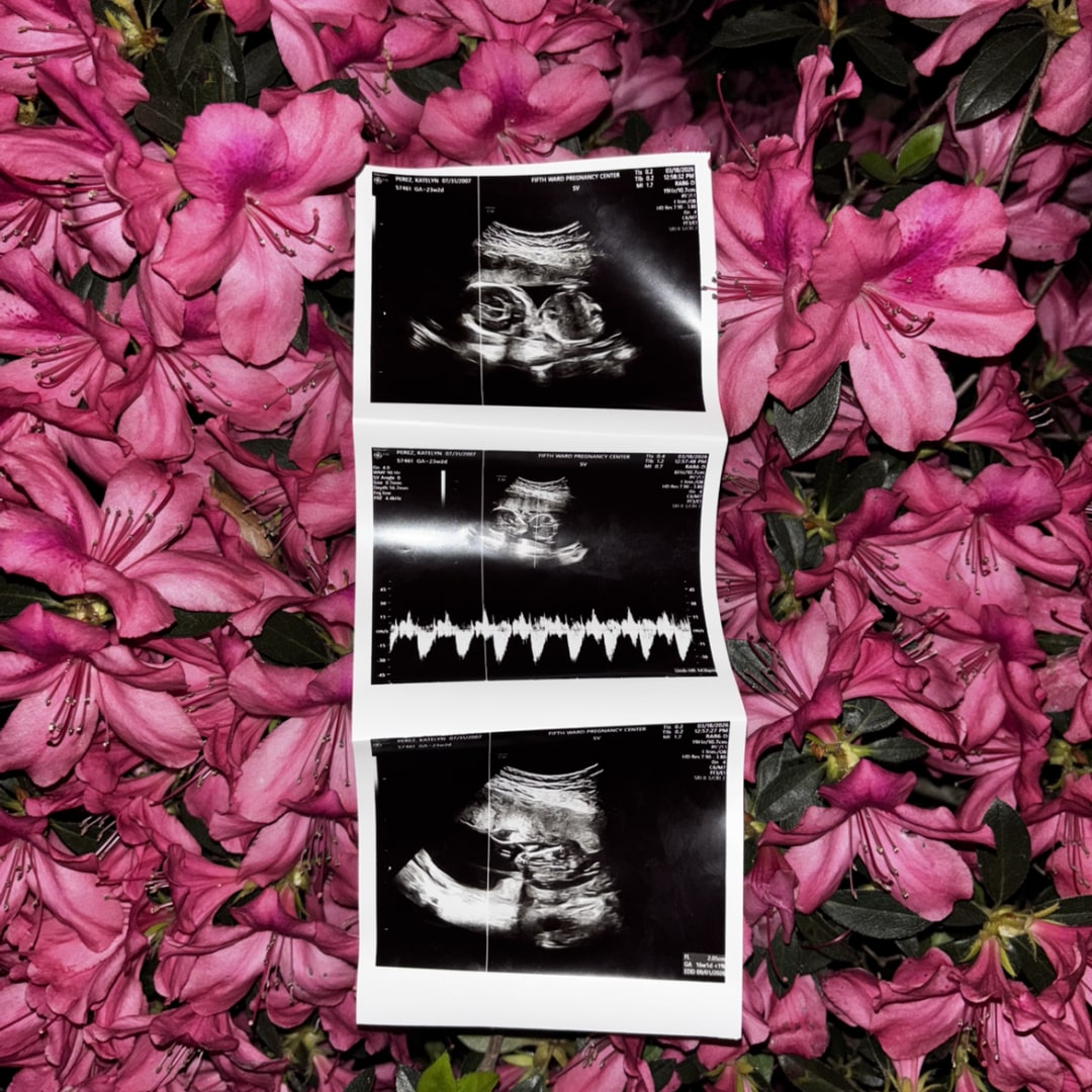 Photo shared by Xavi for their Babylist baby registry.