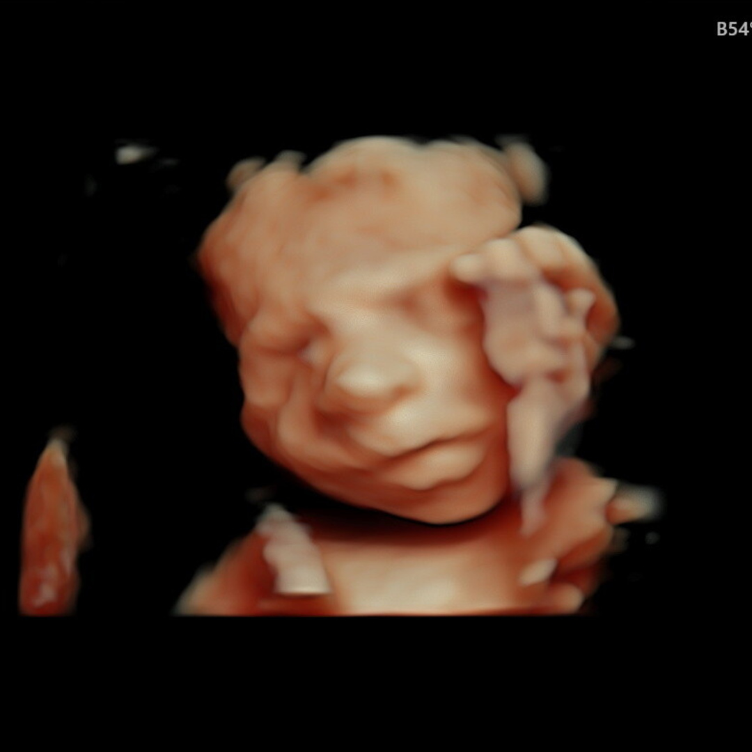 Photo shared by Nicole for their Babylist baby registry.