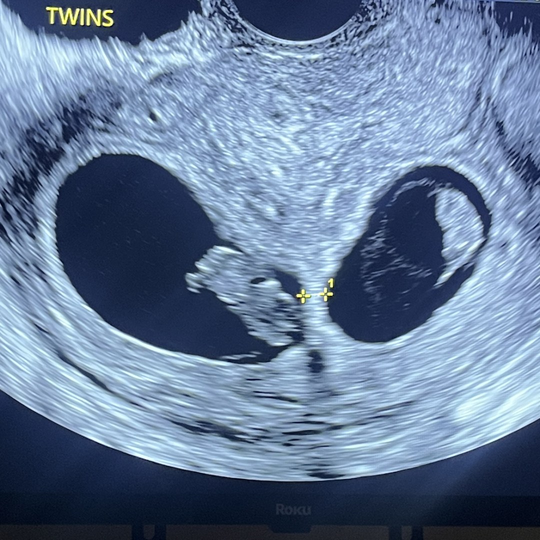 Photo shared by Mattie-mae for their Babylist baby registry.