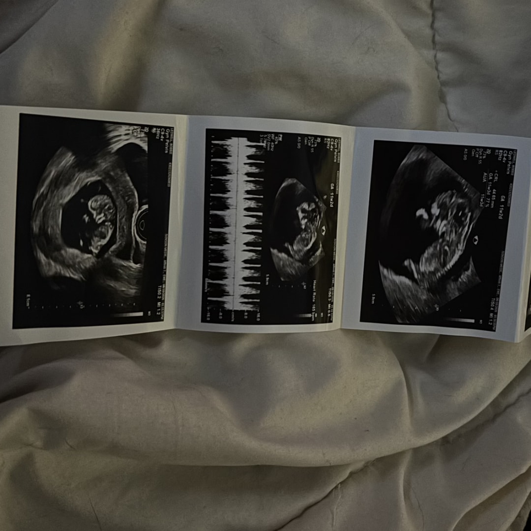 Photo shared by Bobbie for their Babylist baby registry.
