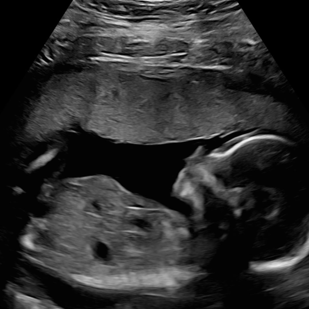 Photo shared by Karlene for their Babylist baby registry.