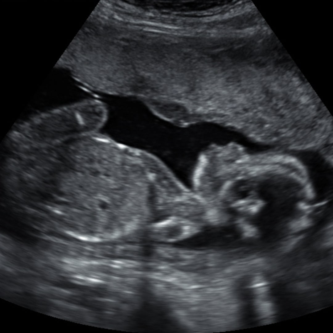 Photo shared by Eliza for their Babylist baby registry.