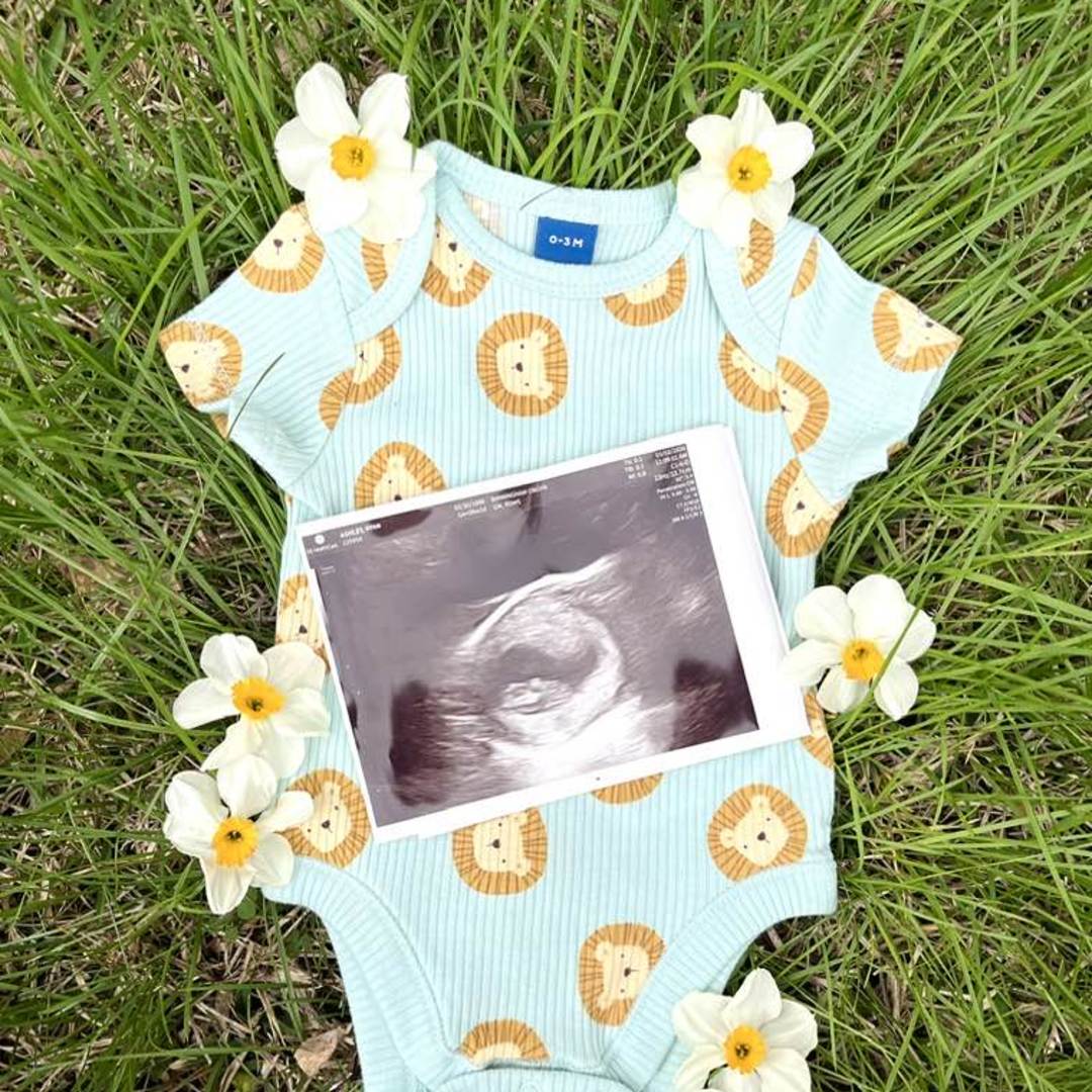 Photo shared by Ryan for their Babylist baby registry.