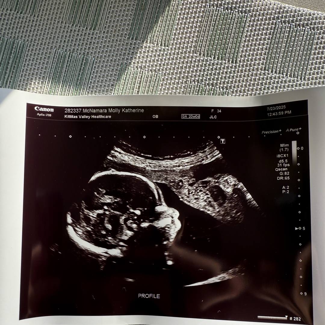 Photo shared by Molly for their Babylist baby registry.