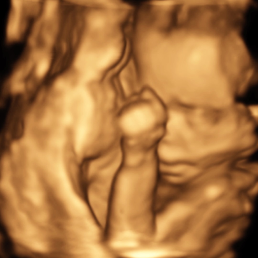 Photo shared by Kendall for their Babylist baby registry.