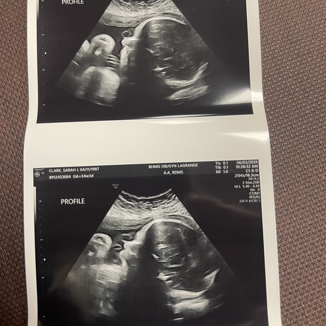 Photo shared by Sarah for their Babylist baby registry.
