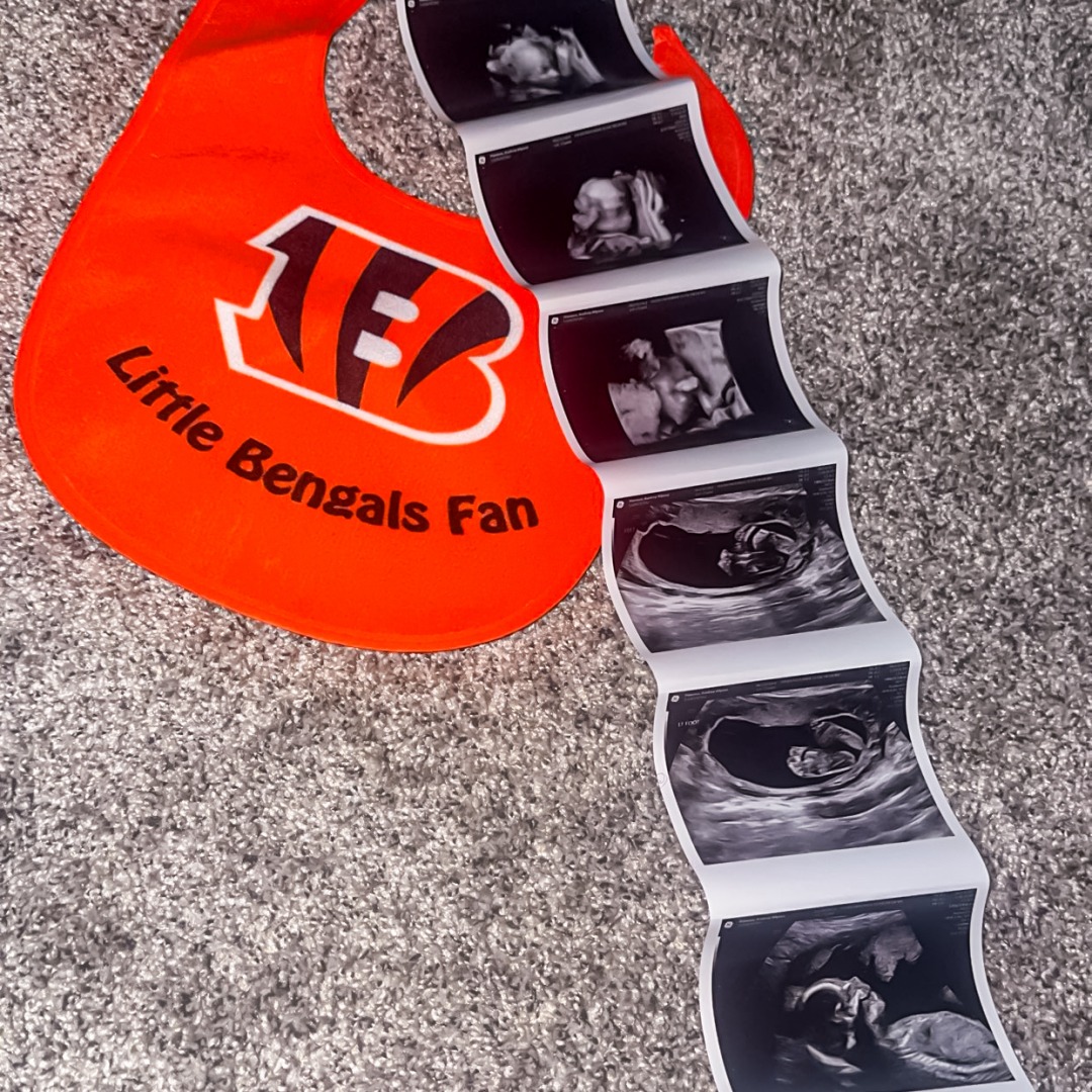 Photo shared by Audrey for their Babylist baby registry.
