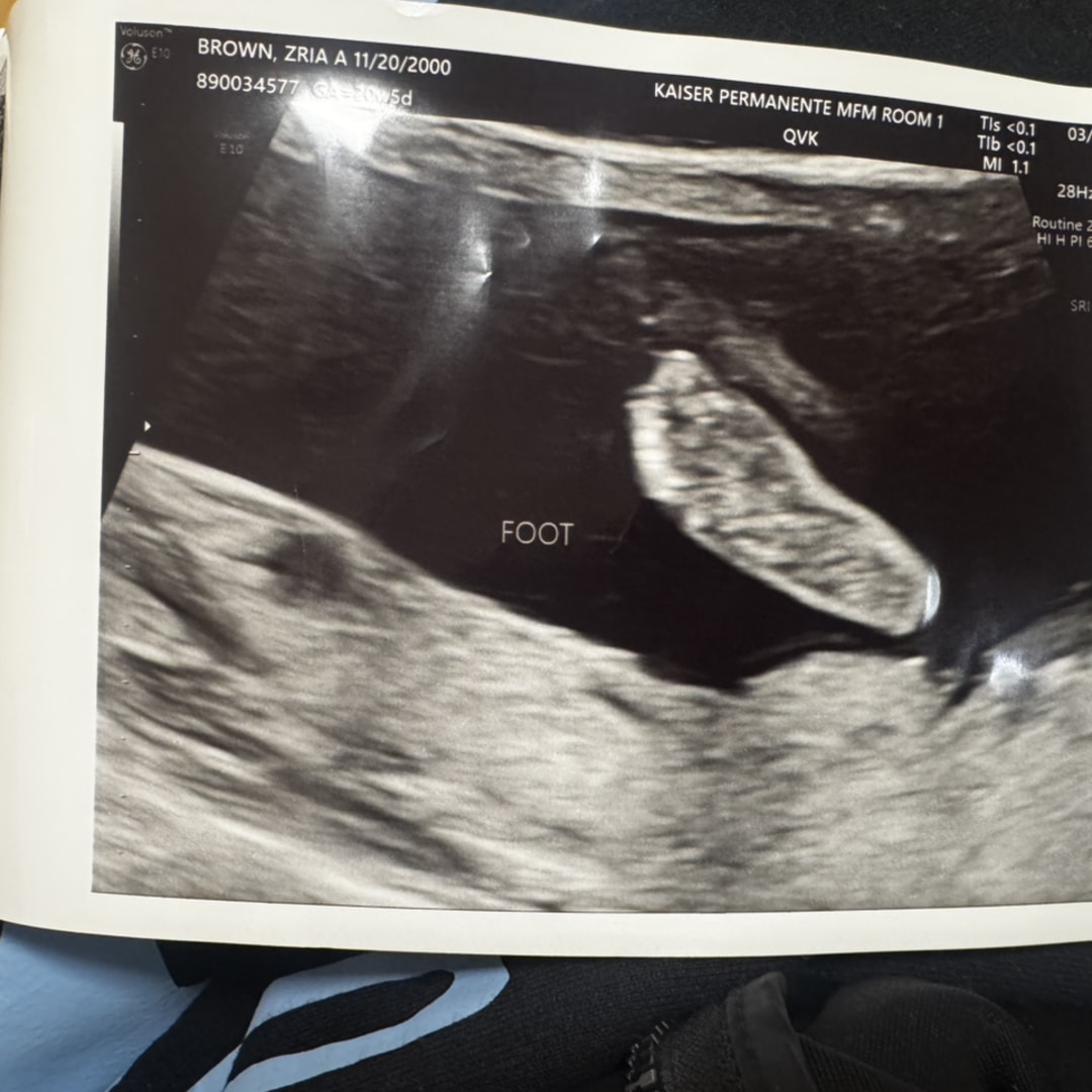 Photo shared by Z'ria for their Babylist baby registry.