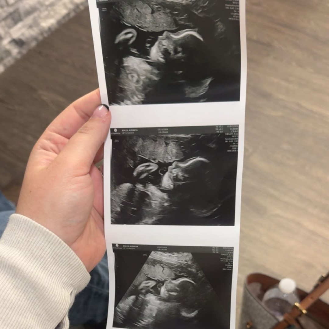 Photo shared by Audreya for their Babylist baby registry.