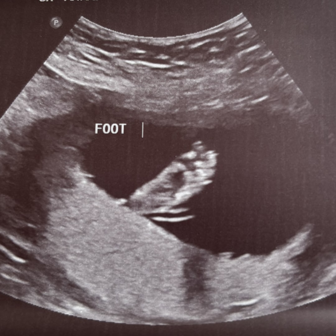 Photo shared by Madeline for their Babylist baby registry.