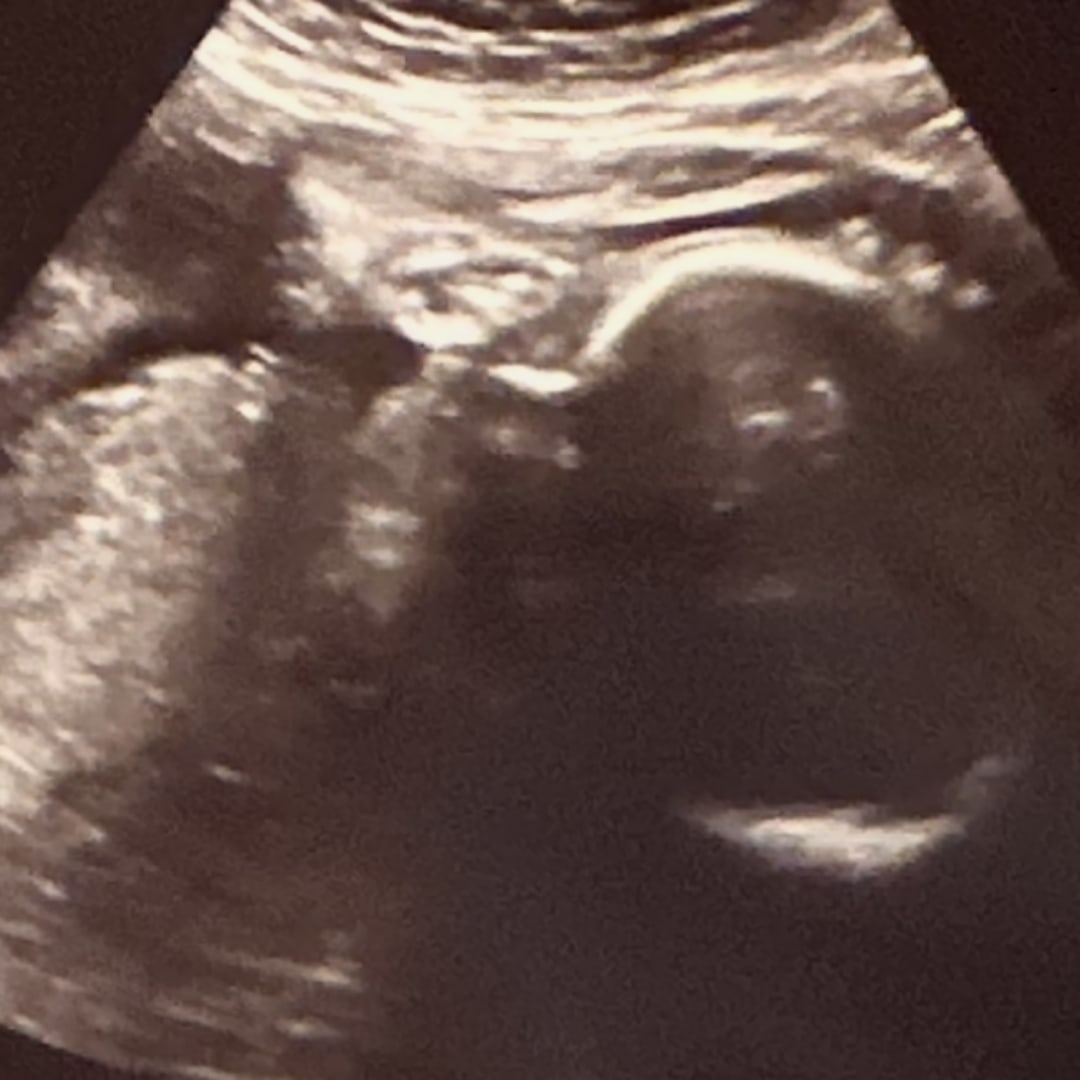 Photo shared by Aly for their Babylist baby registry.