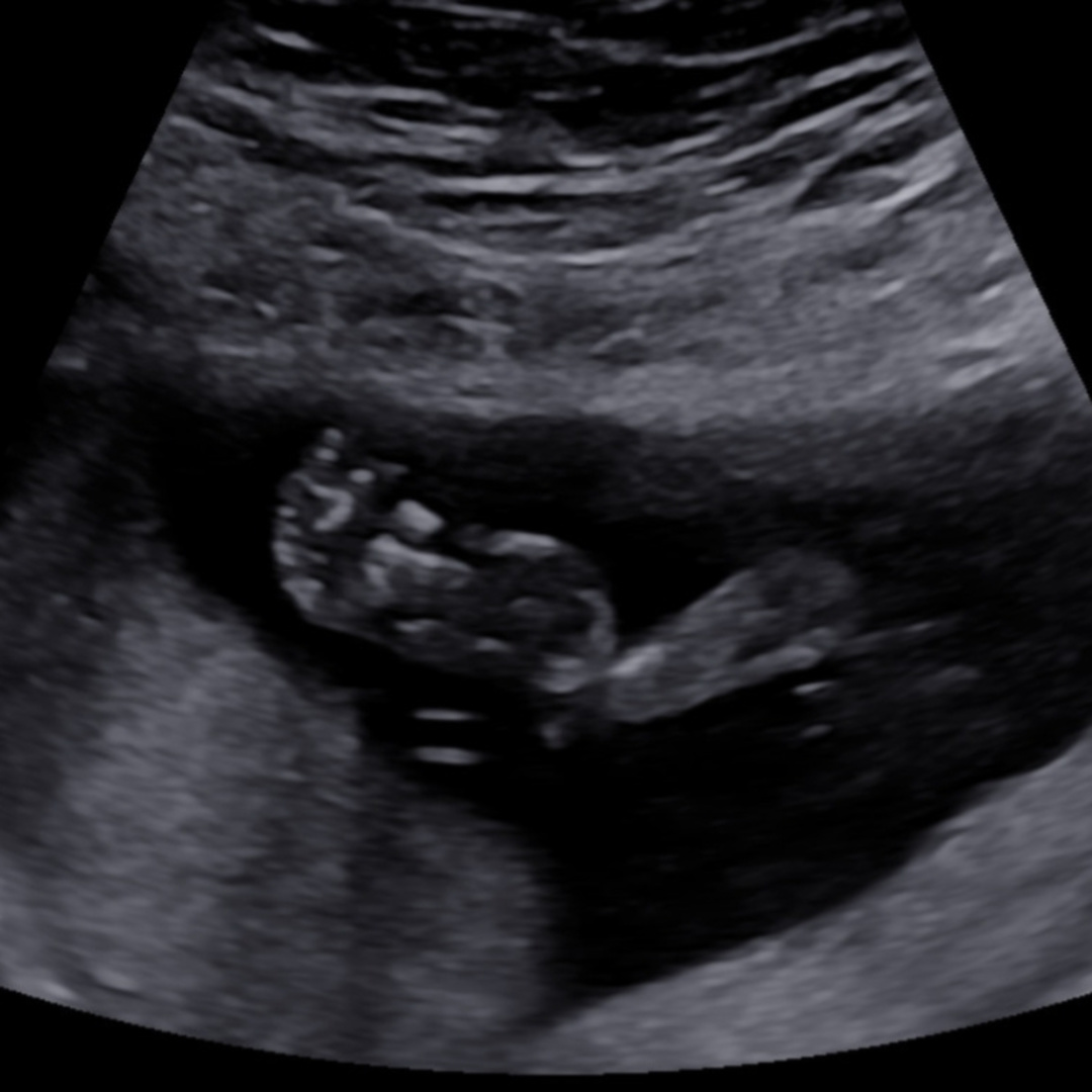 Photo shared by Amber for their Babylist baby registry.