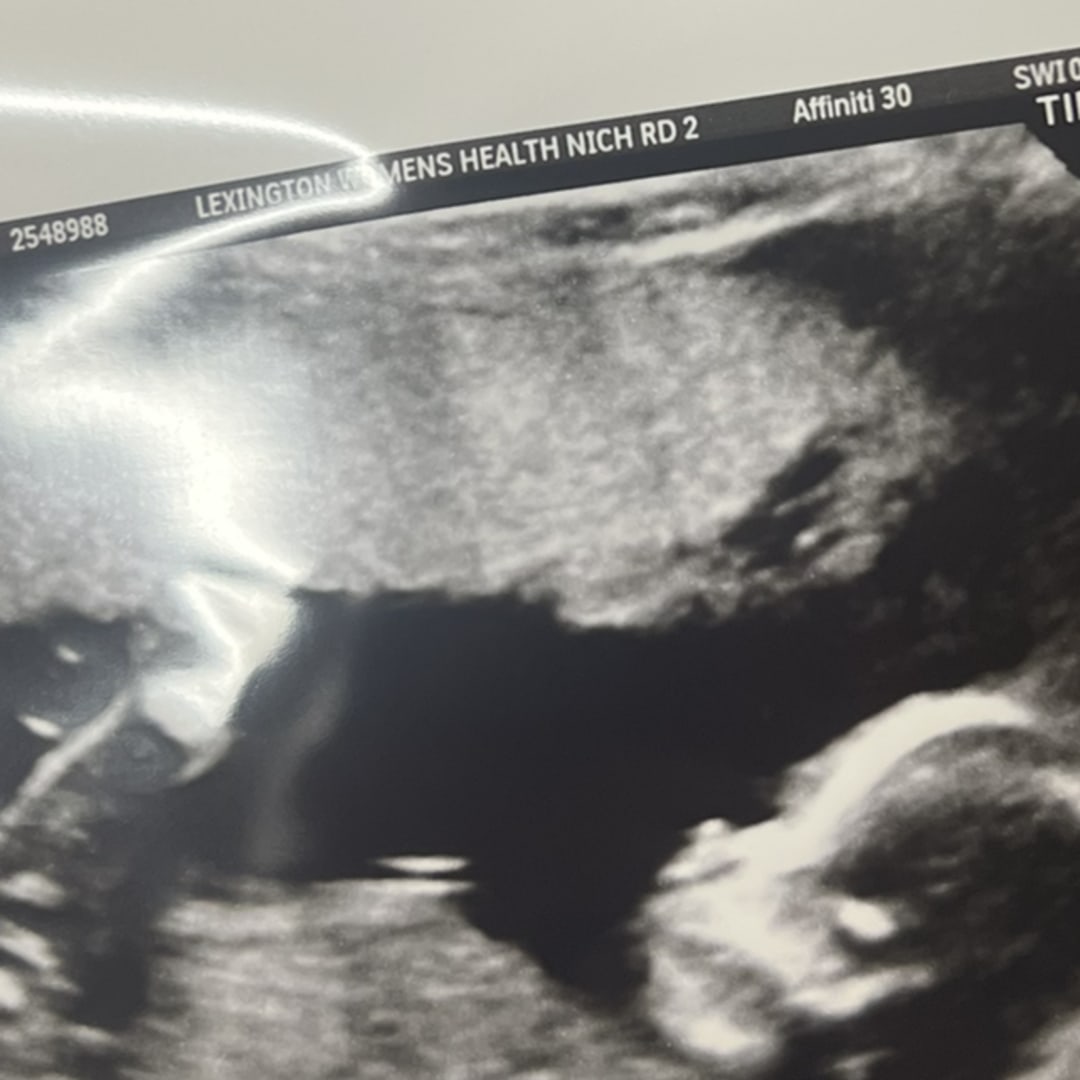 Photo shared by Brittany for their Babylist baby registry.