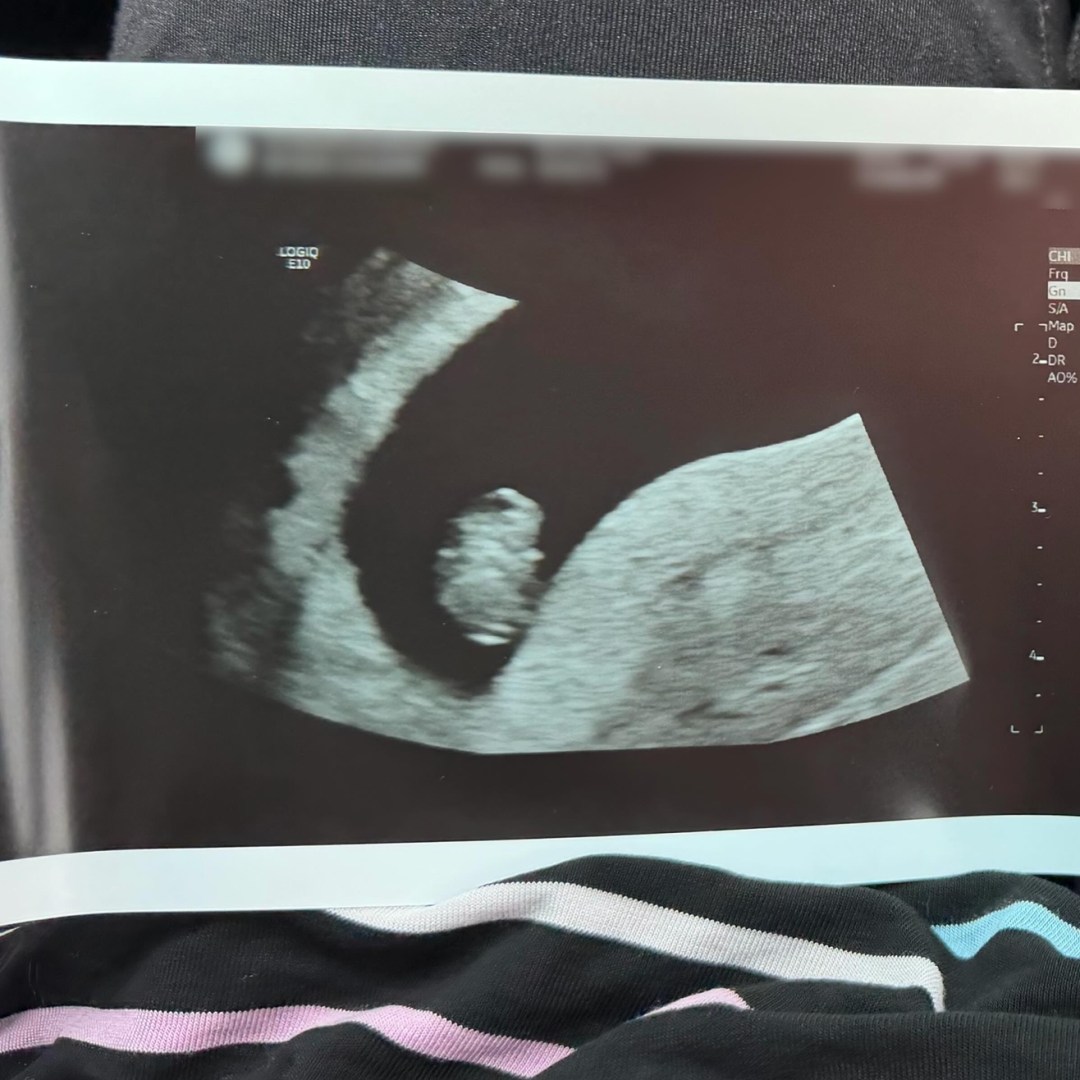Photo shared by Gayle for their Babylist baby registry.