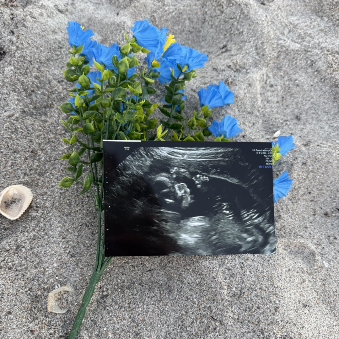 Photo shared by Jessica for their Babylist baby registry.