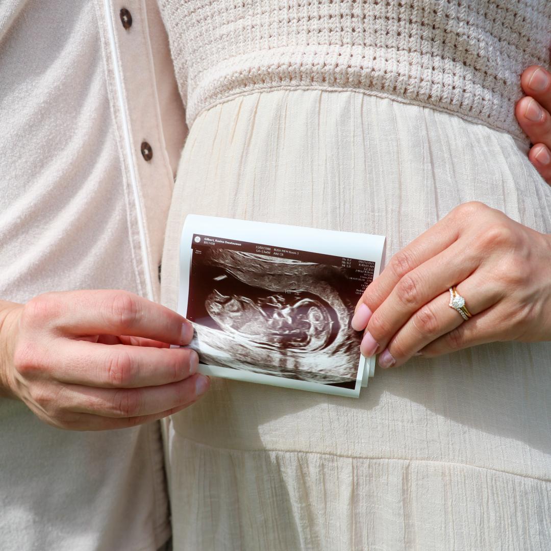 Photo shared by Kasina for their Babylist baby registry.