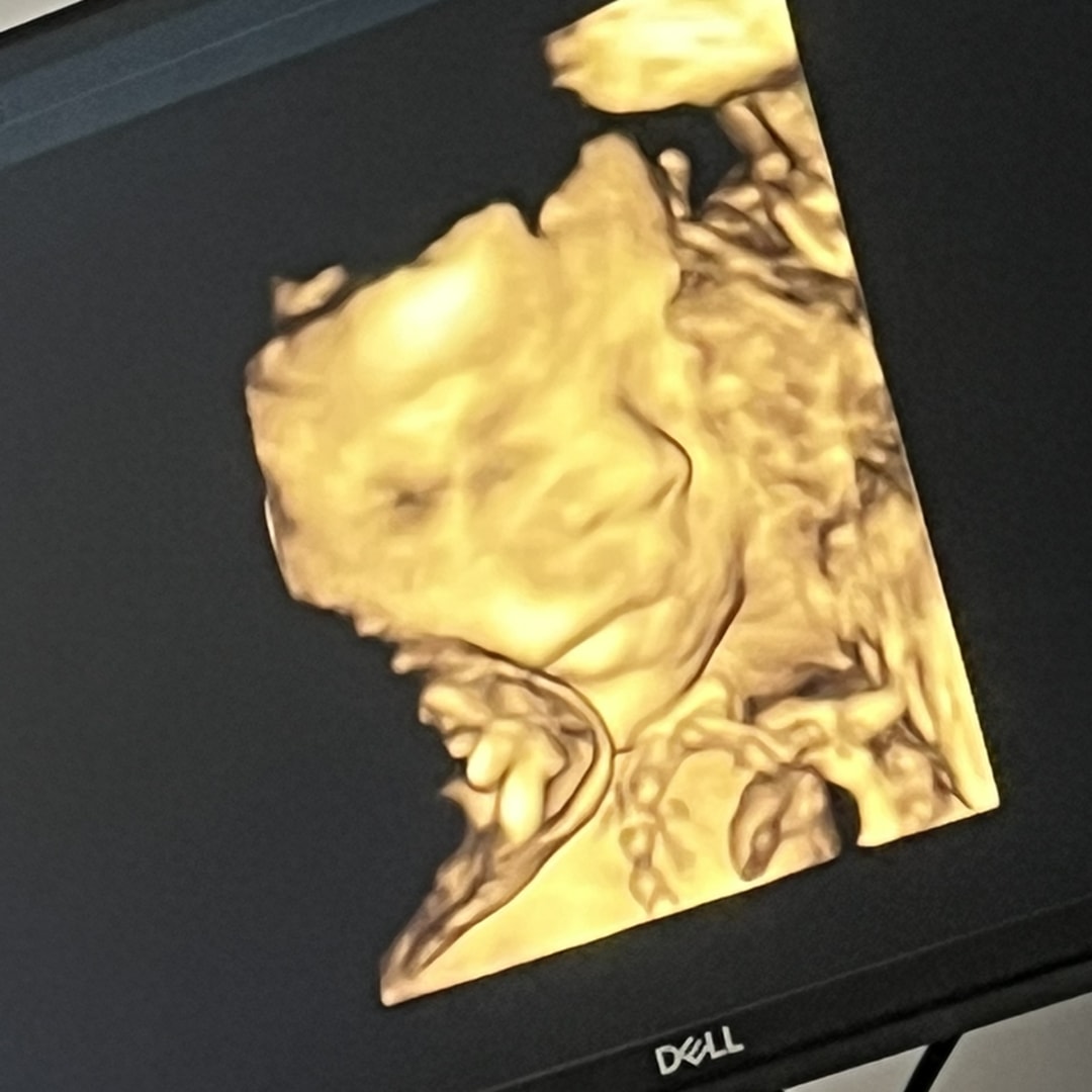 Photo shared by Cindy for their Babylist baby registry.