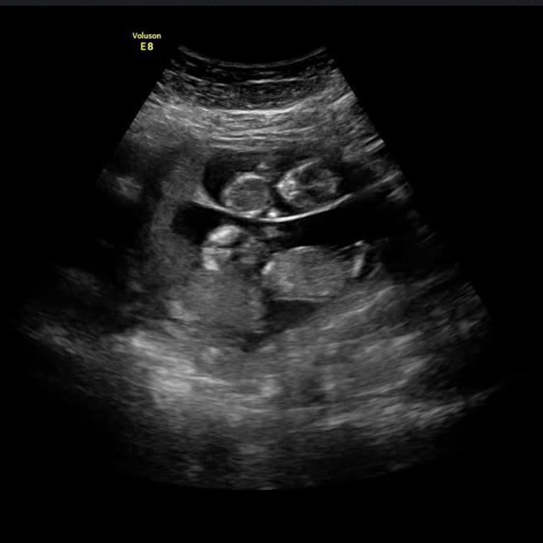 Photo shared by Brooke for their Babylist baby registry.