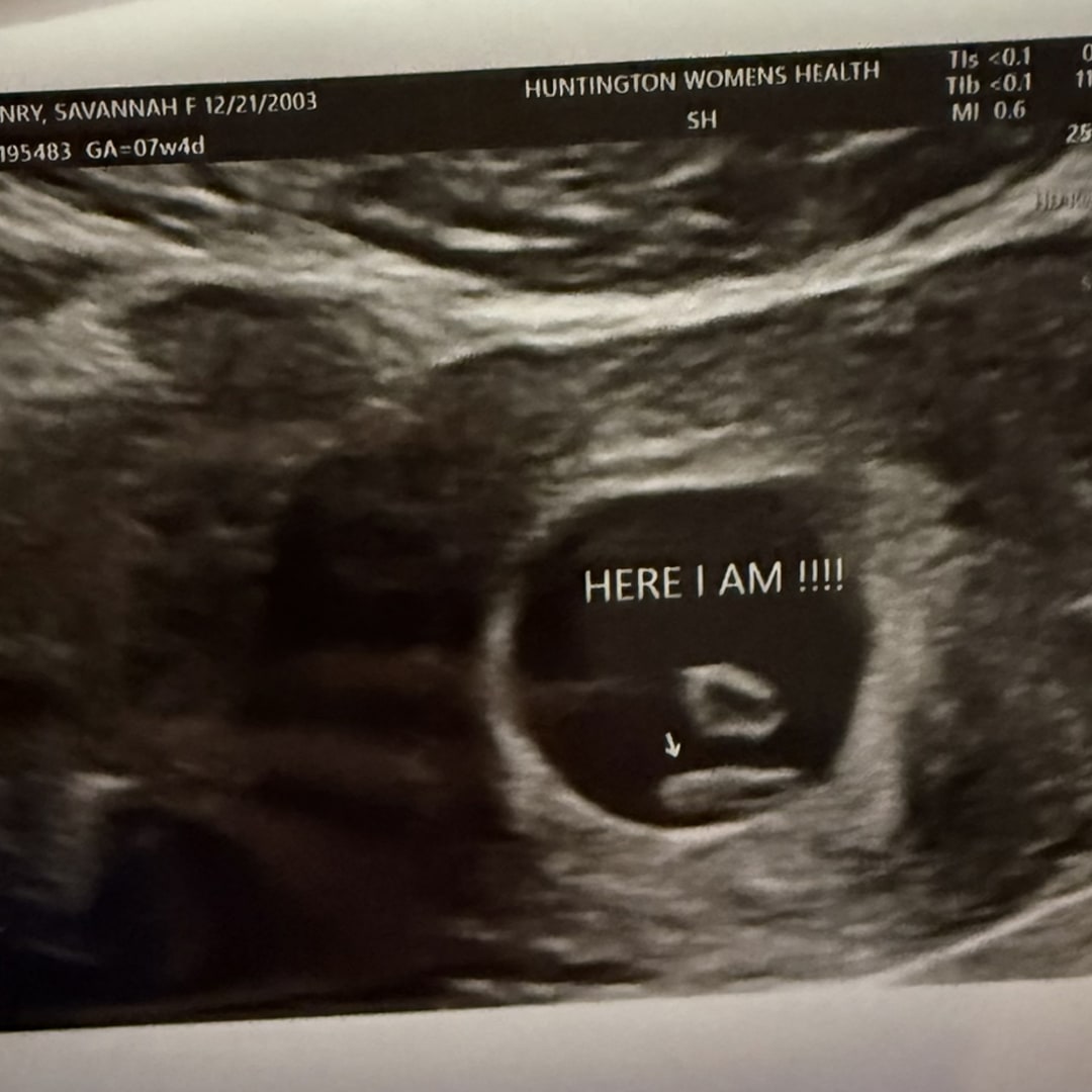 Photo shared by Savannah for their Babylist baby registry.