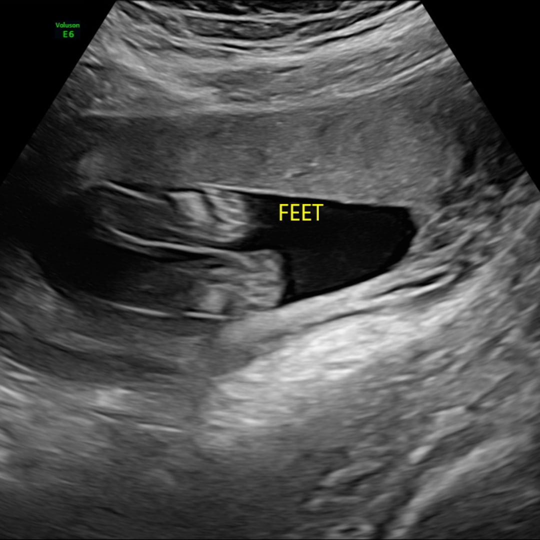 Photo shared by Brinlee for their Babylist baby registry.
