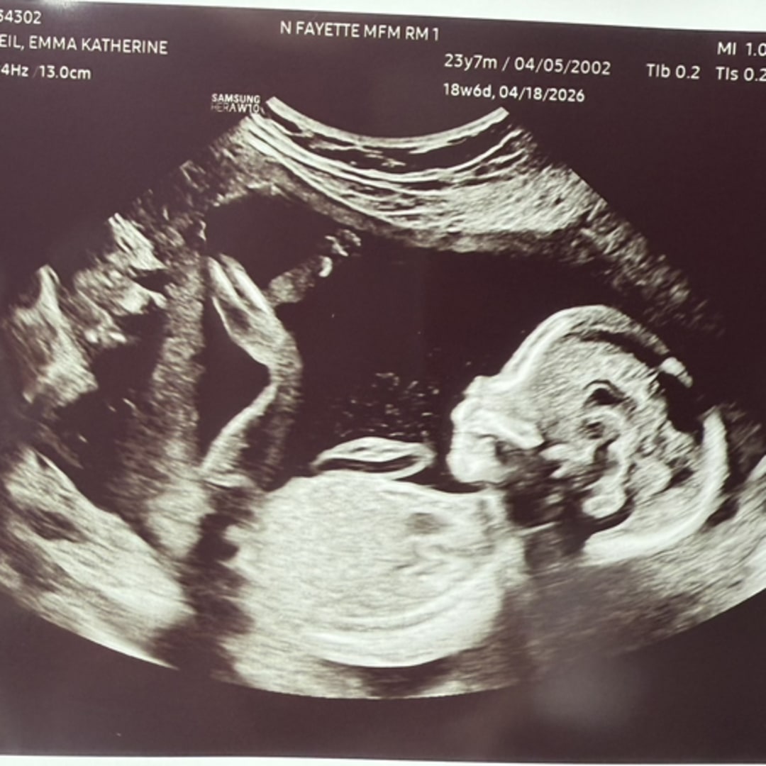 Photo shared by Emma for their Babylist baby registry.