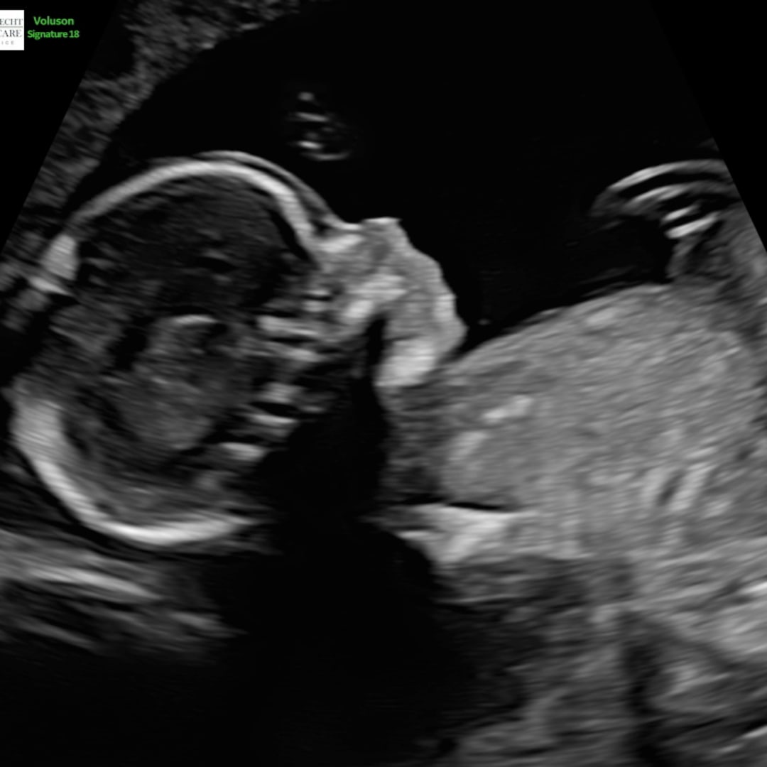 Photo shared by Dalaney for their Babylist baby registry.