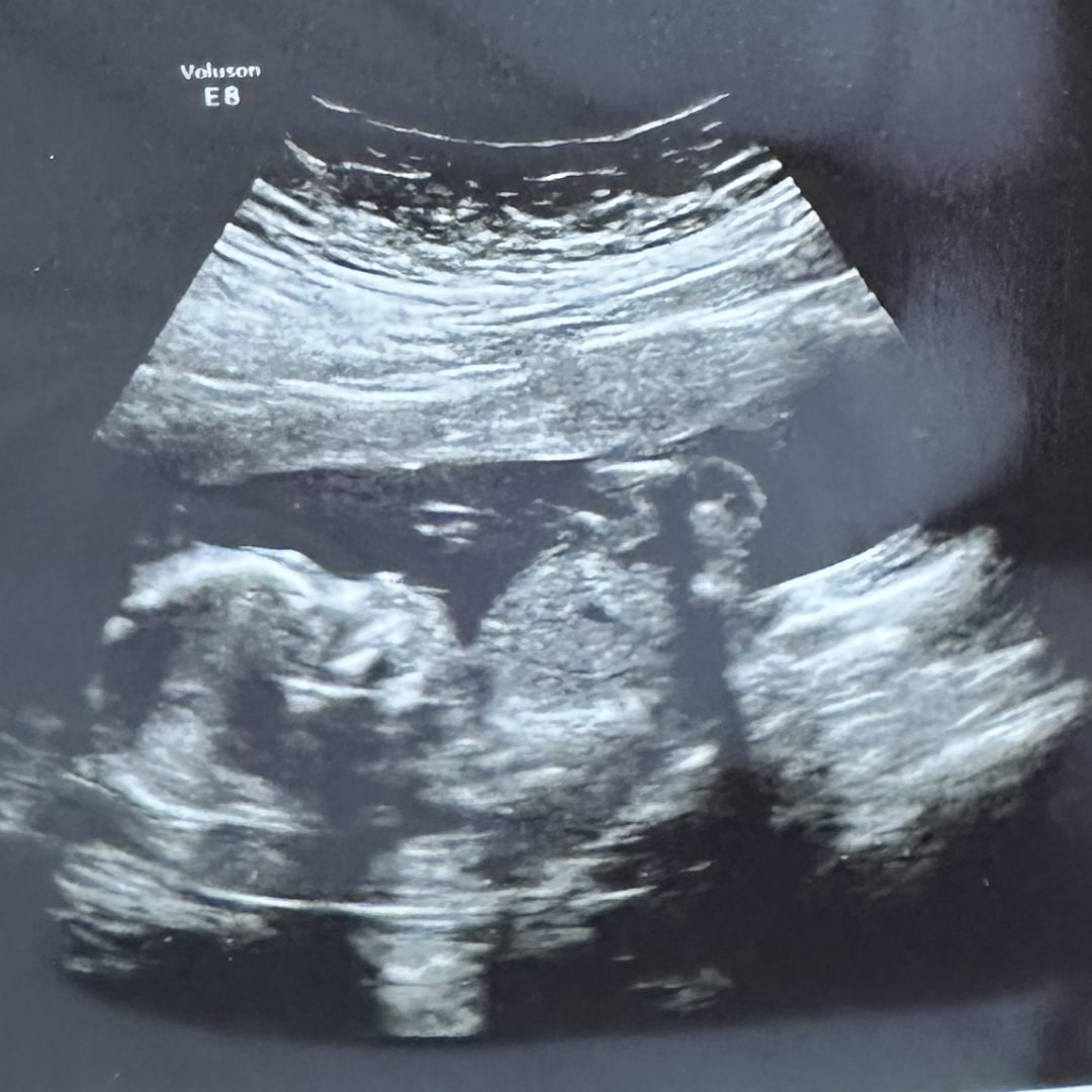 Photo shared by Alyssa for their Babylist baby registry.