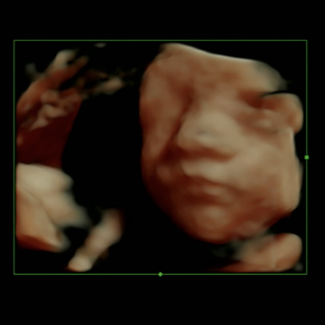 Photo shared by Clara for their Babylist baby registry.