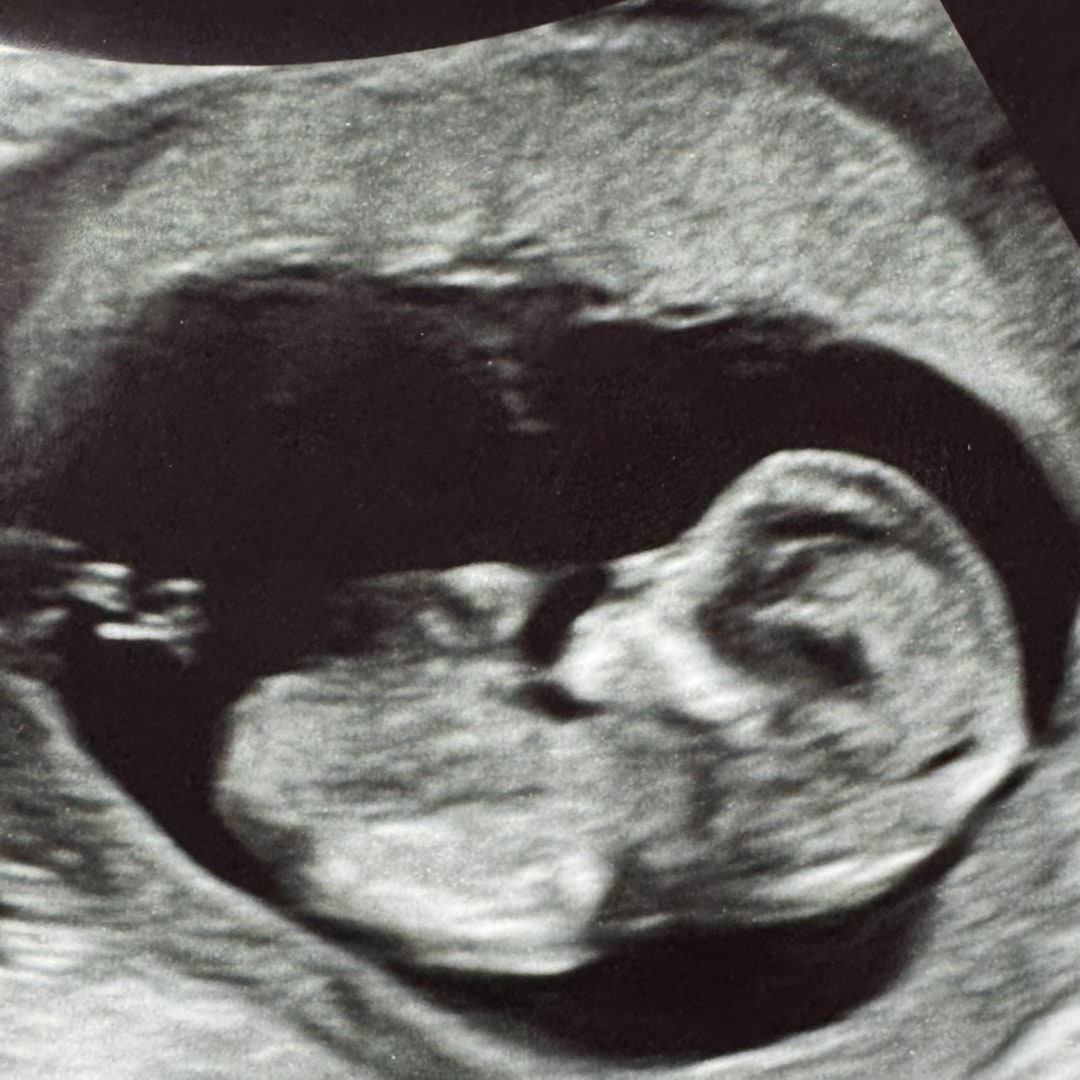 Photo shared by Mckinly for their Babylist baby registry.