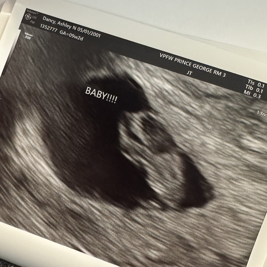 Photo shared by Ashley for their Babylist baby registry.