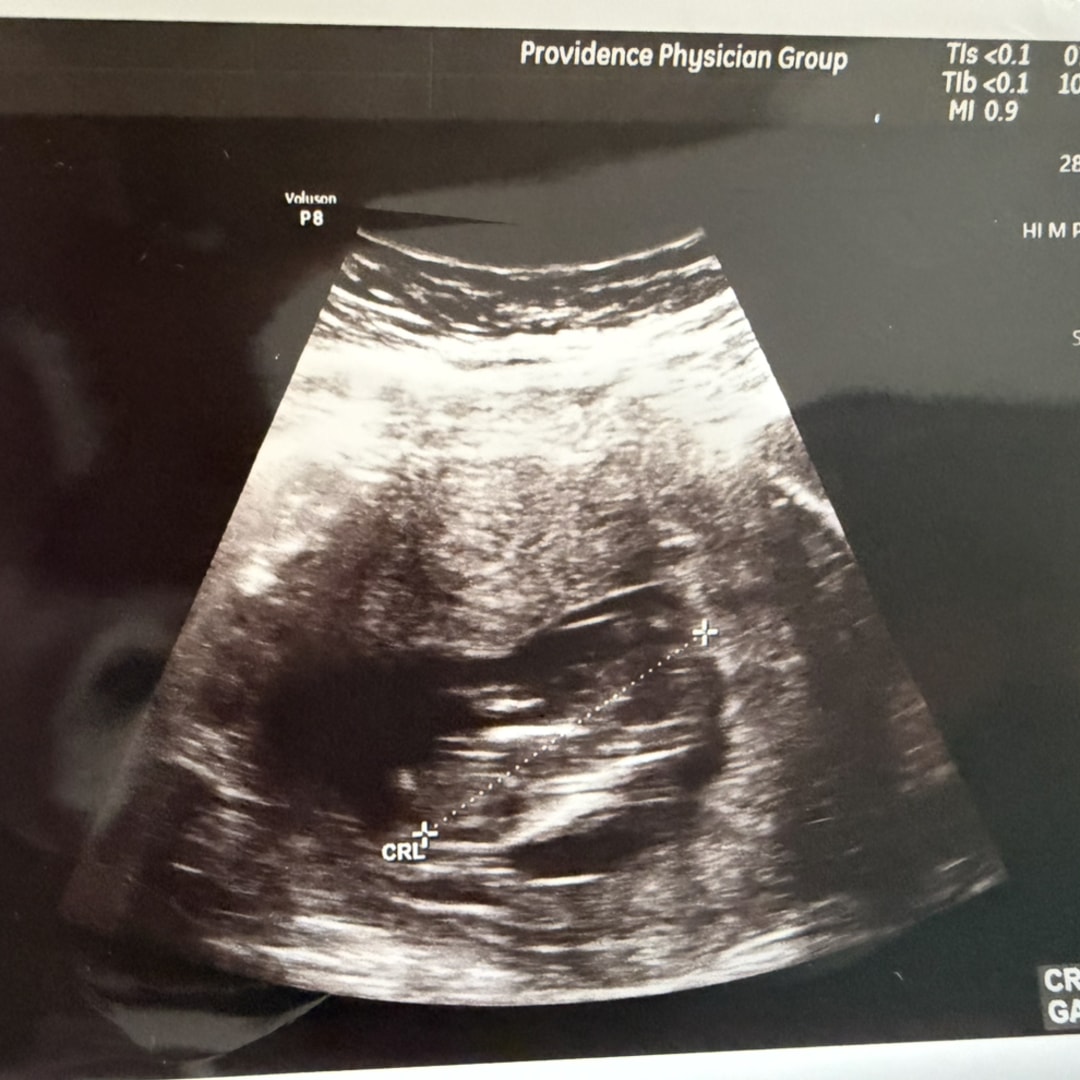 Photo shared by Renee for their Babylist baby registry.