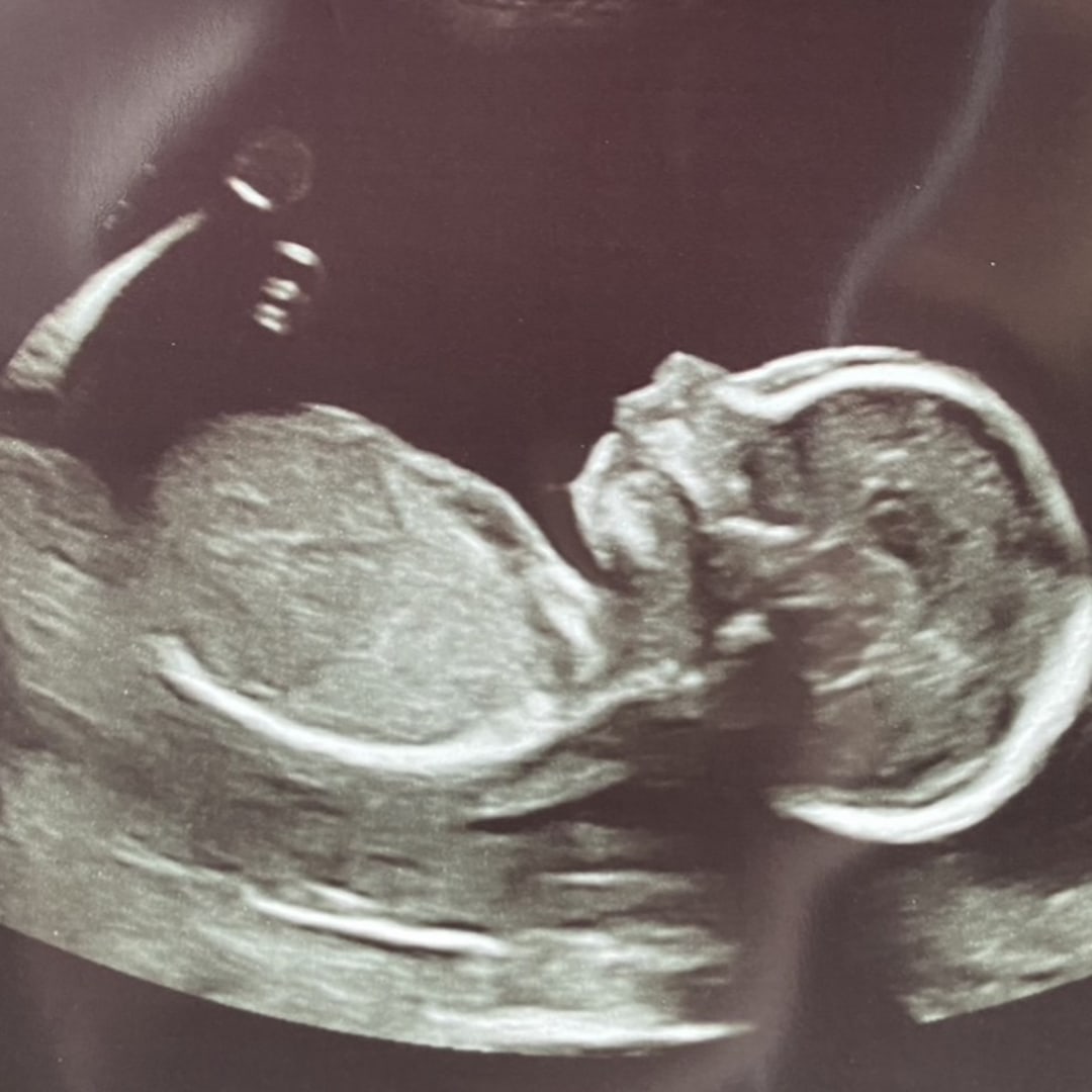 Photo shared by Nikki for their Babylist baby registry.