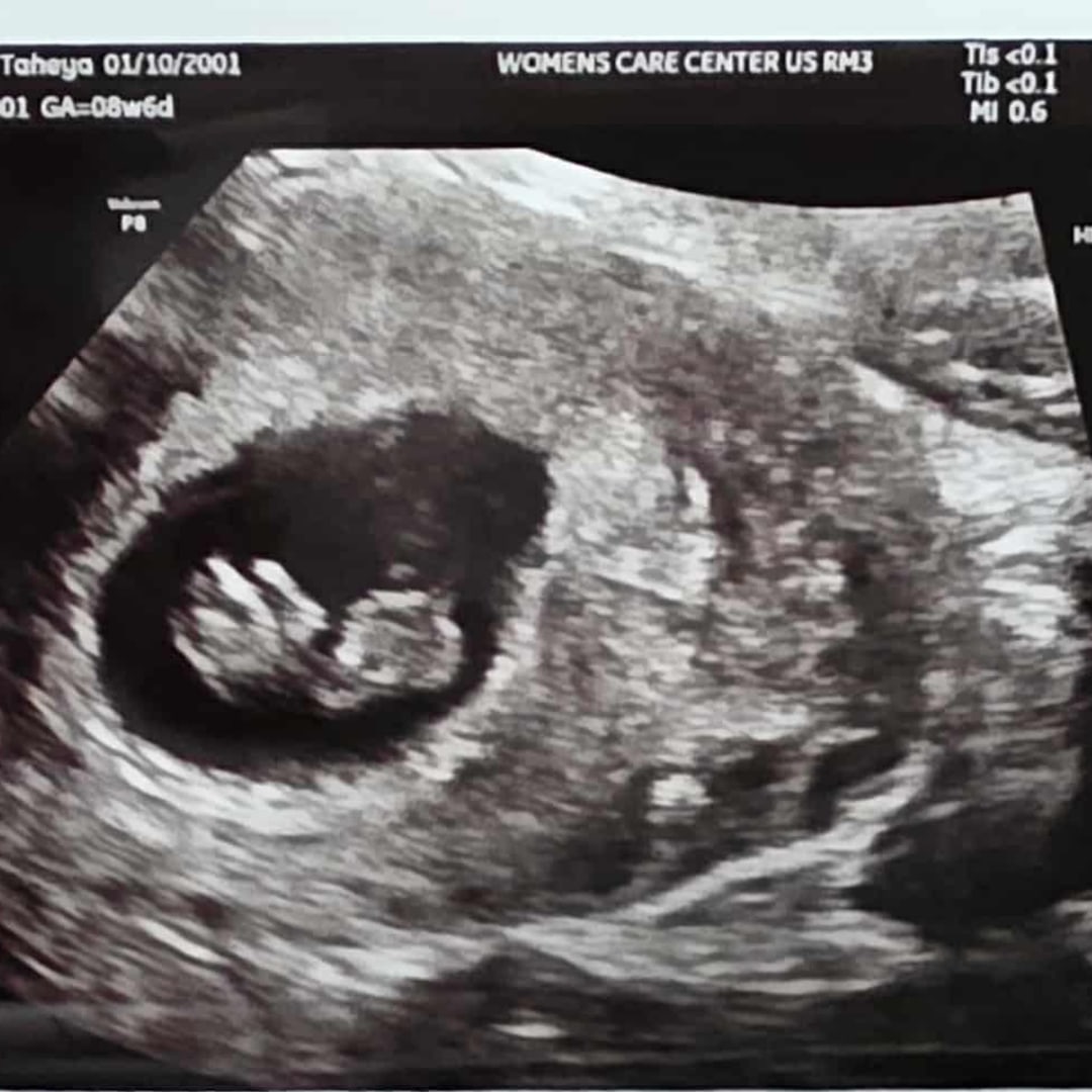 Photo shared by Taheya for their Babylist baby registry.