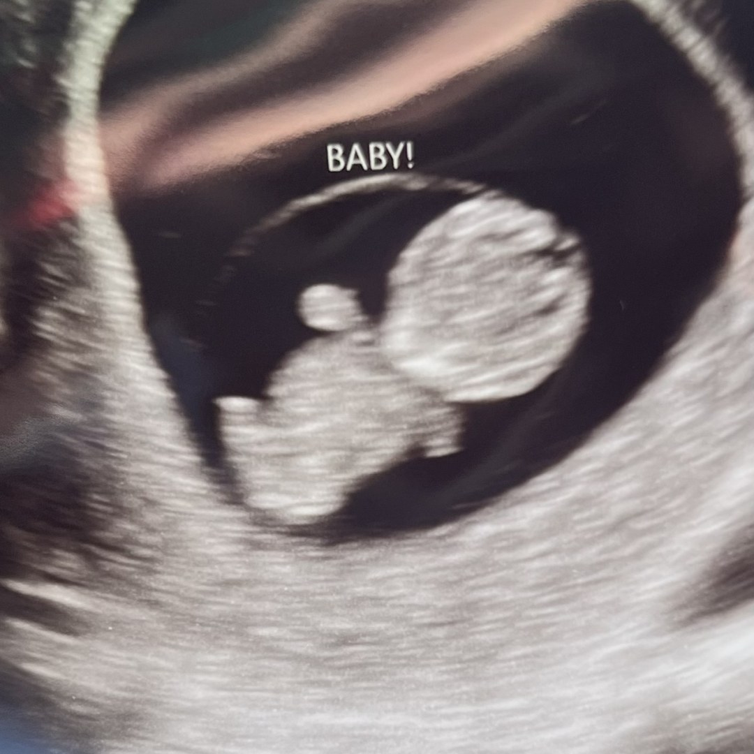 Photo shared by Bethany for their Babylist baby registry.