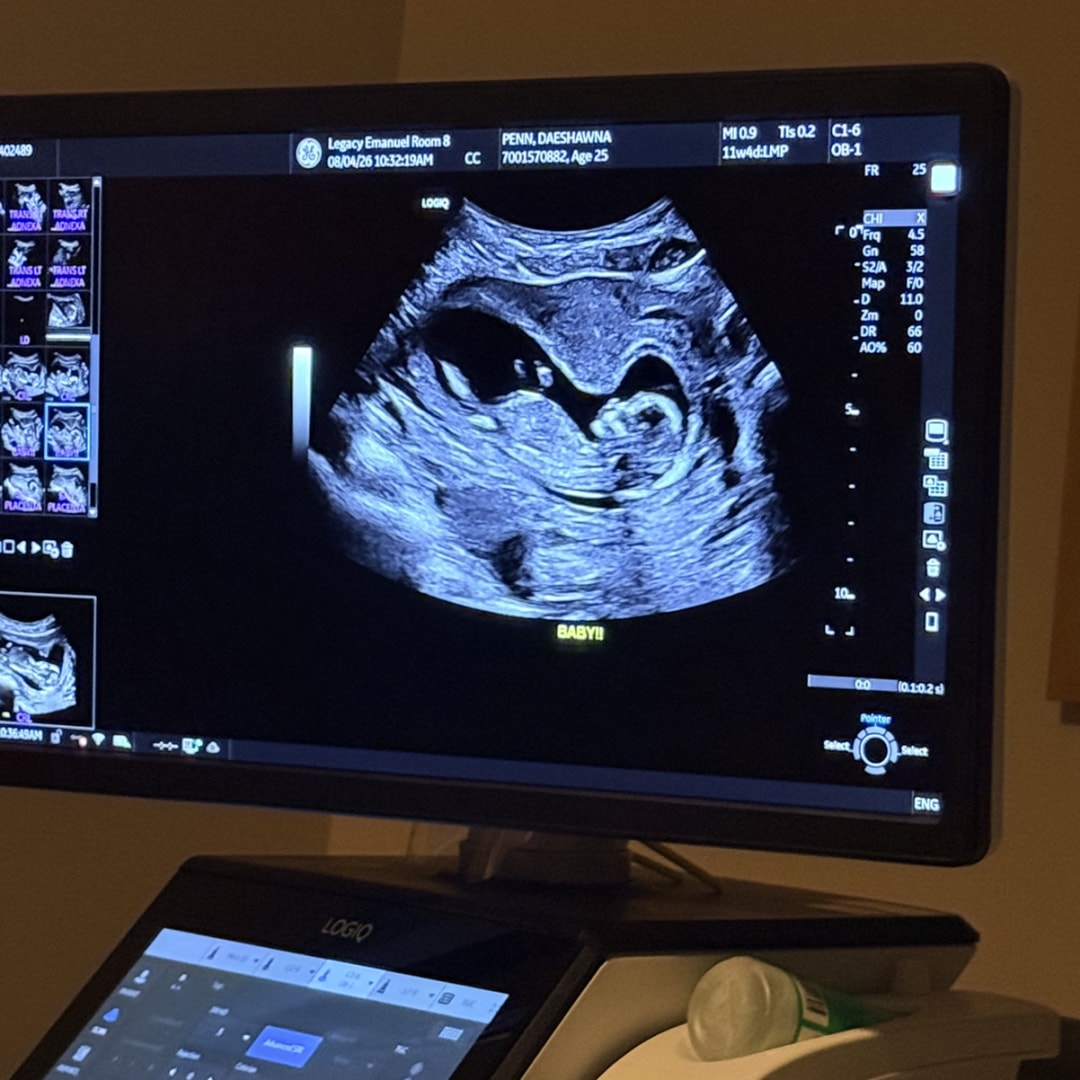 Photo shared by DaeShawna for their Babylist baby registry.