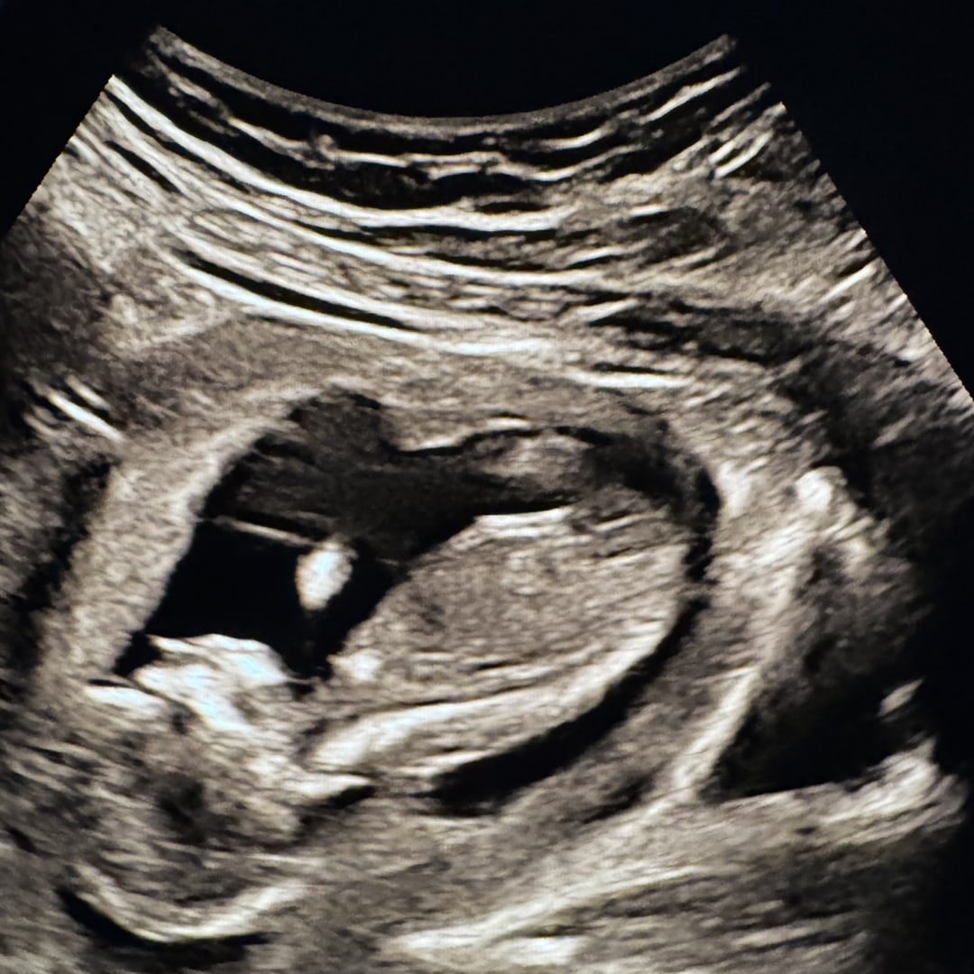 Photo shared by Kelcie for their Babylist baby registry.