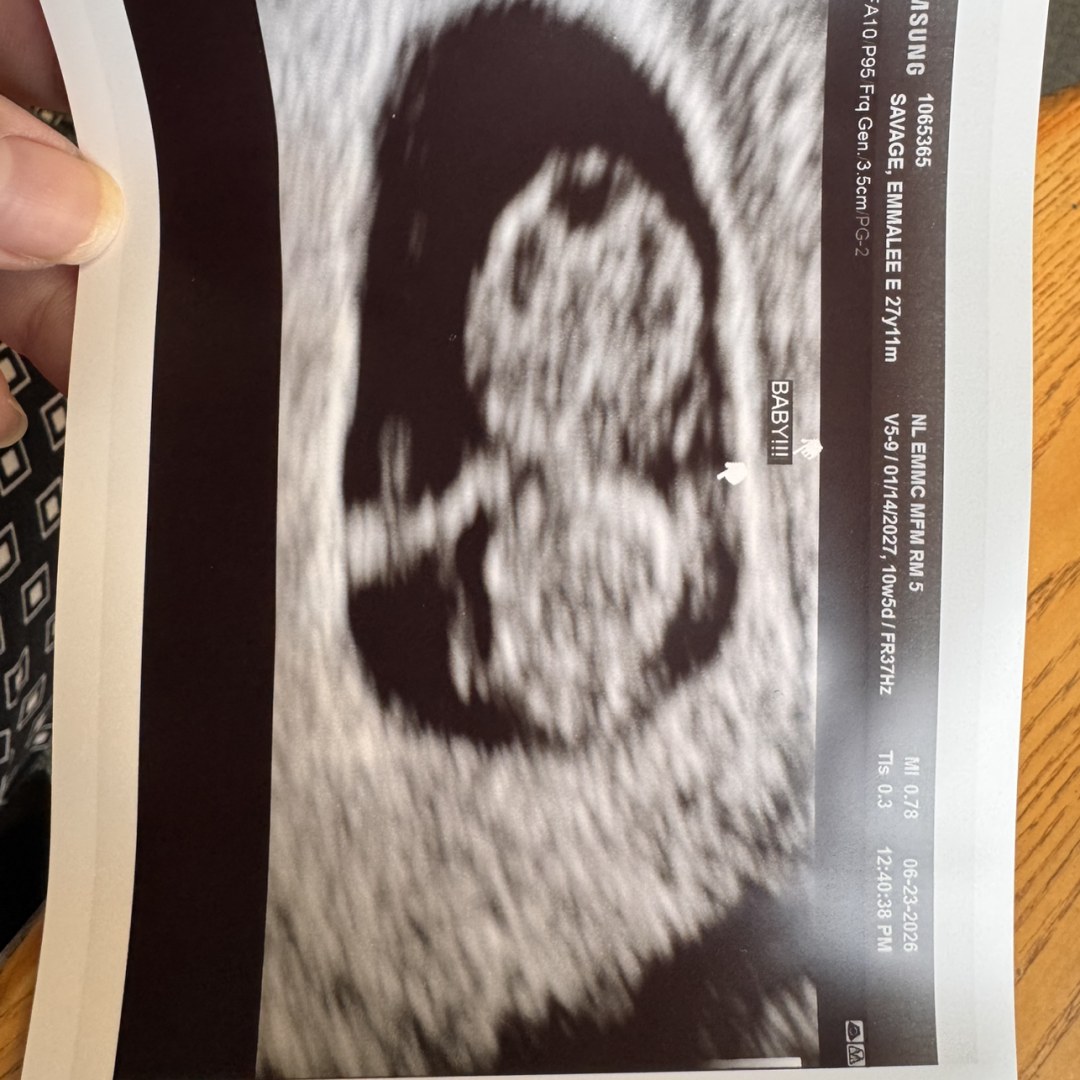 Photo shared by Emmalee for their Babylist baby registry.