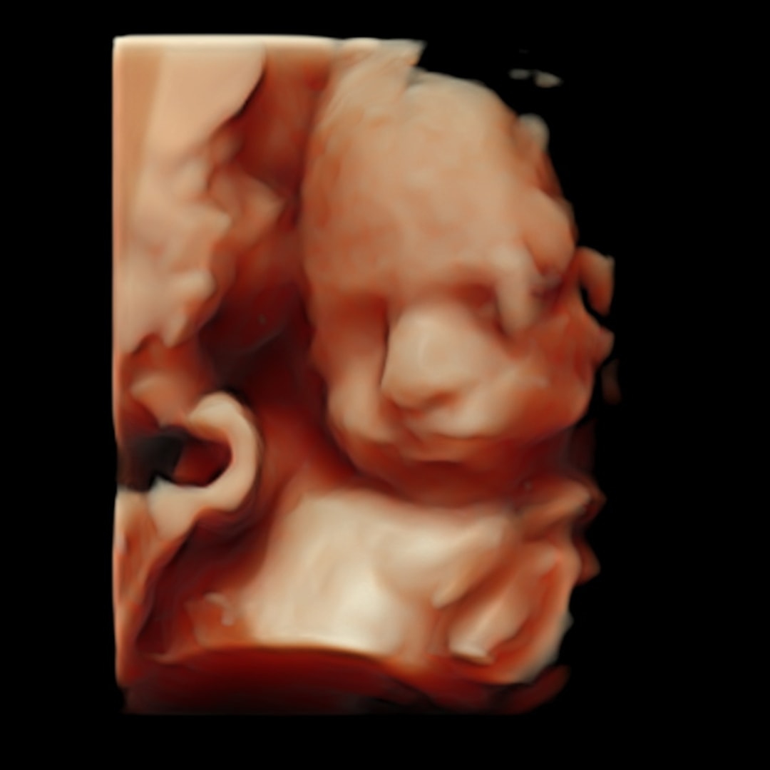 Photo shared by Elizabeth for their Babylist baby registry.