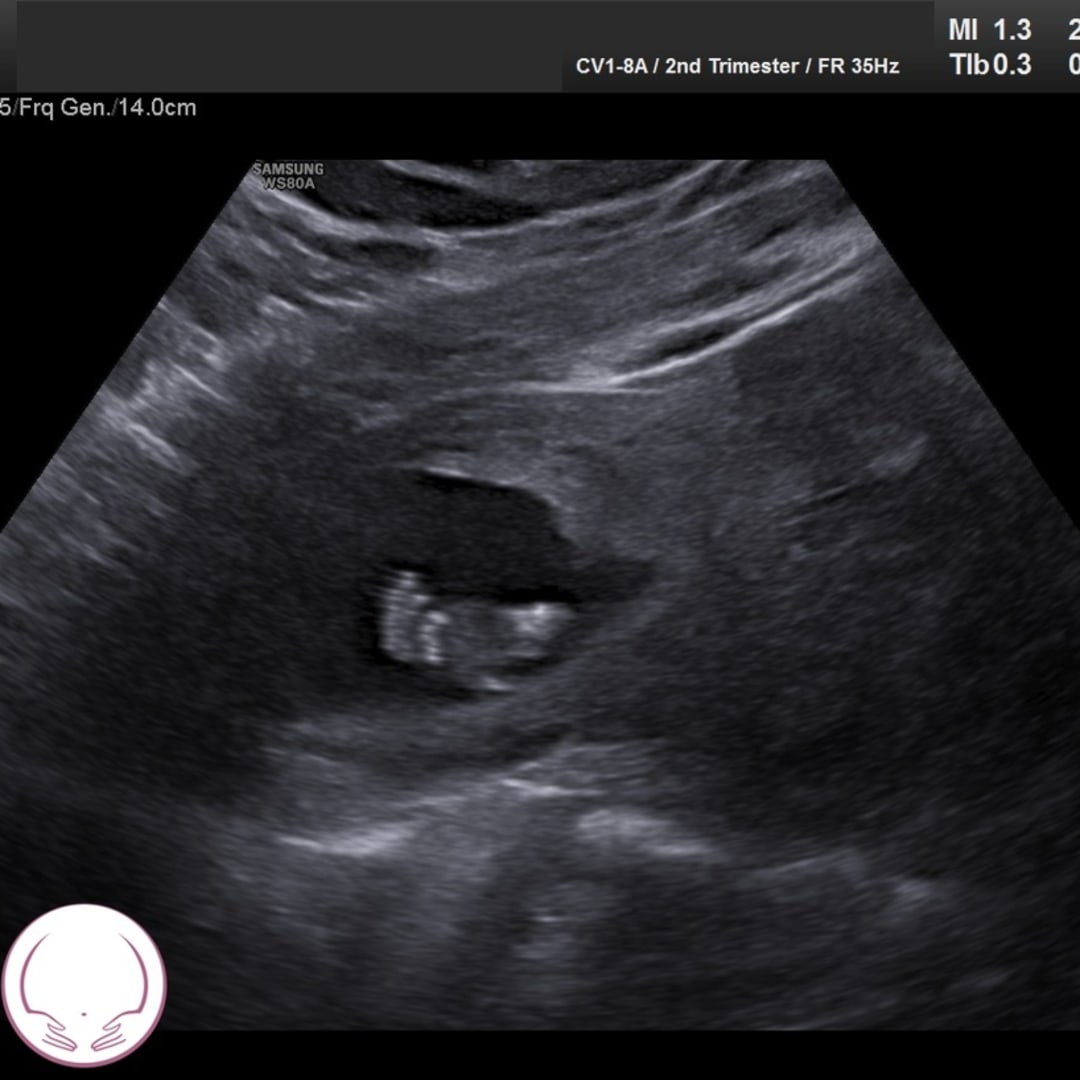 Photo shared by Bailey for their Babylist baby registry.