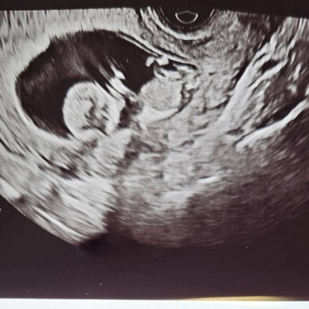 Photo shared by Hannah for their Babylist baby registry.