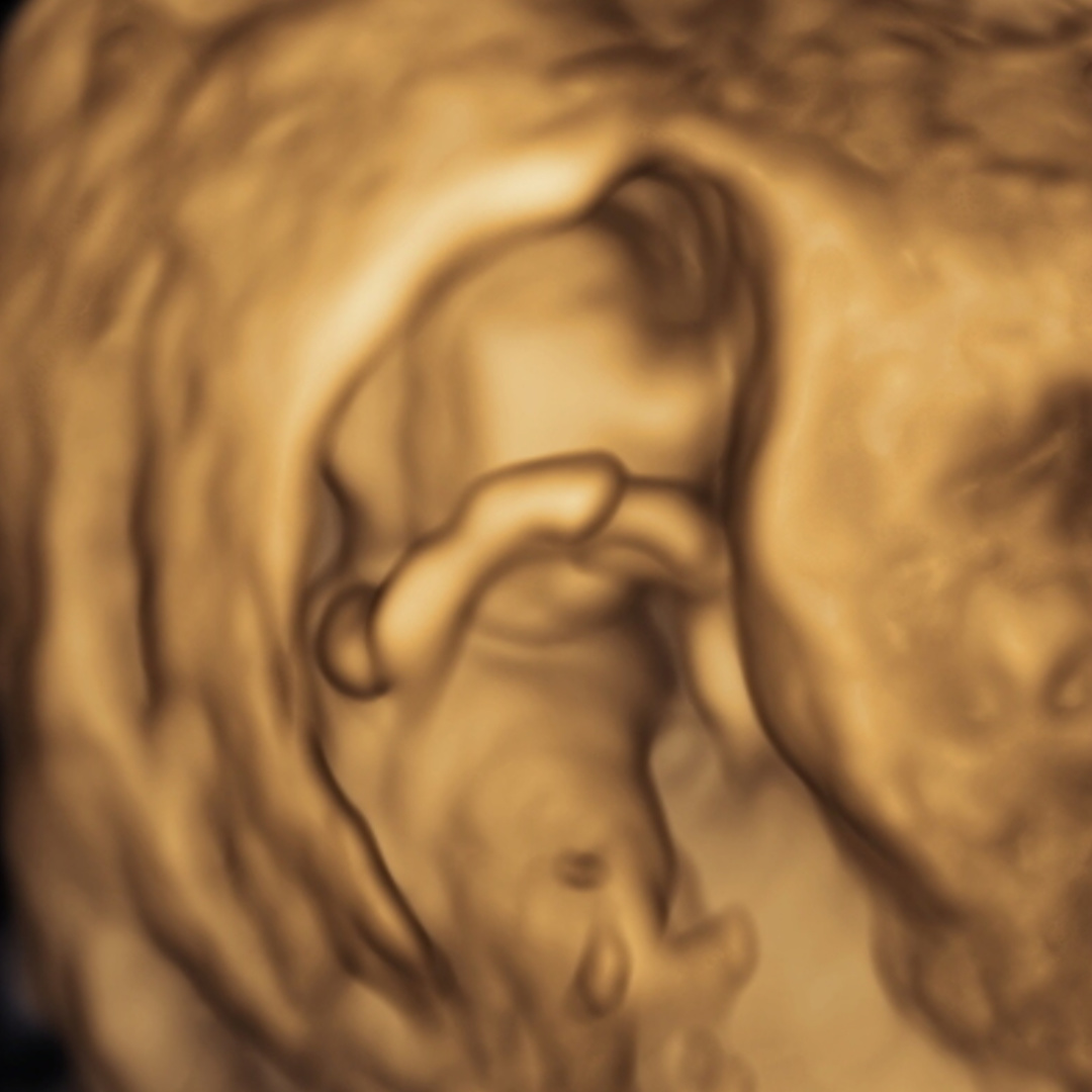 Photo shared by Christopher for their Babylist baby registry.