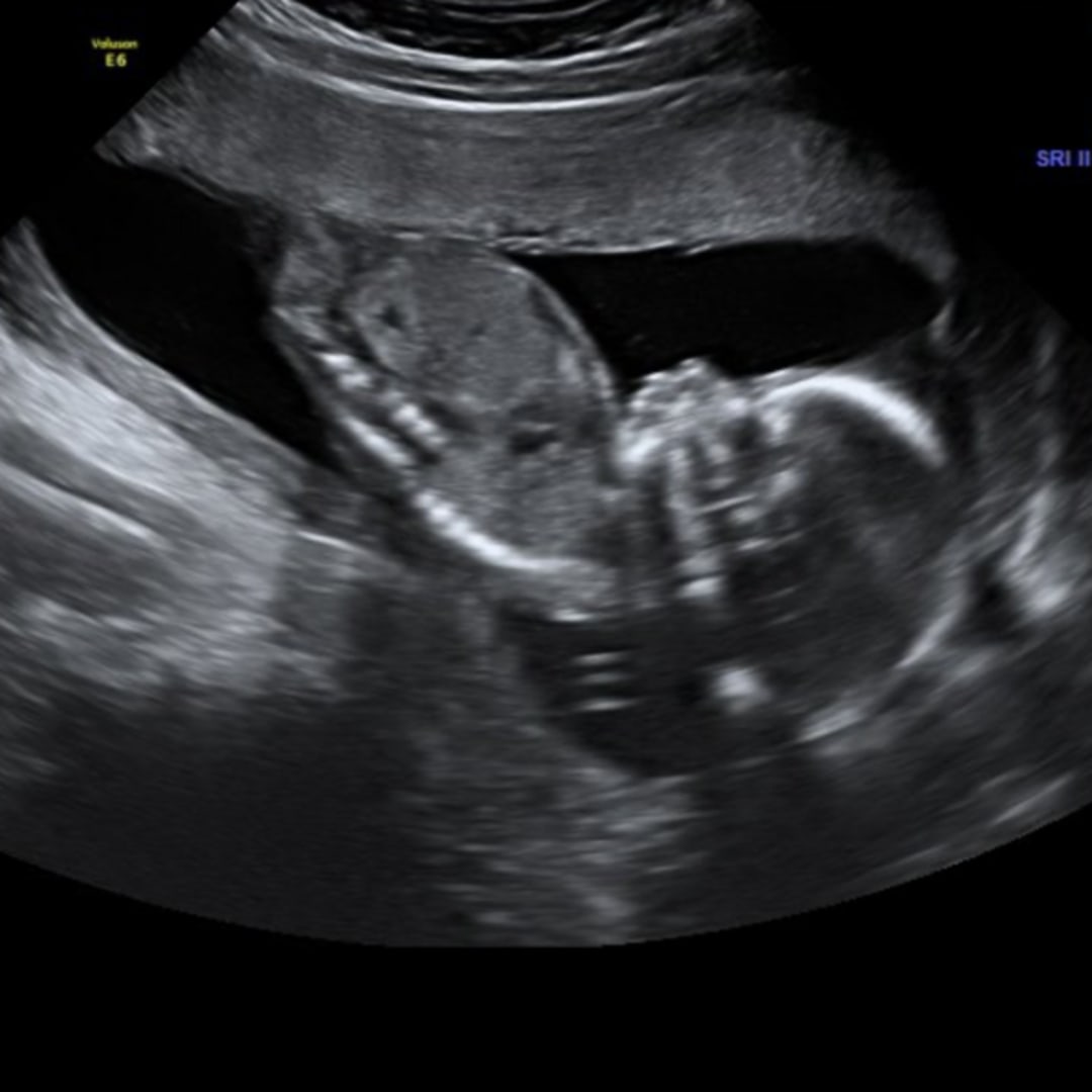 Photo shared by Marley for their Babylist baby registry.