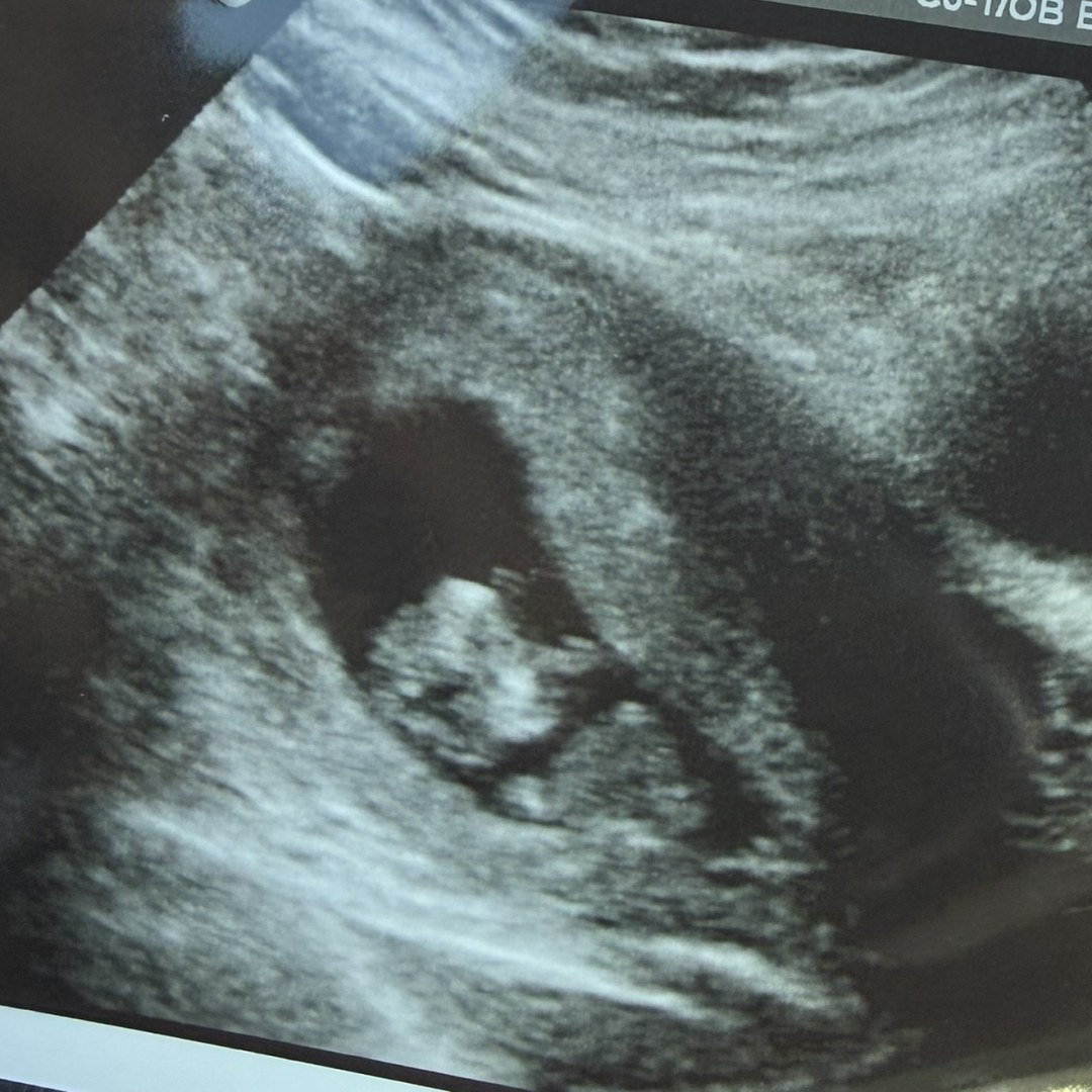 Photo shared by Andrea for their Babylist baby registry.