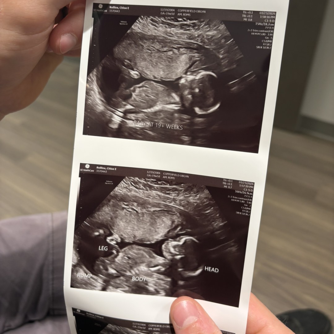 Photo shared by Chloe for their Babylist baby registry.