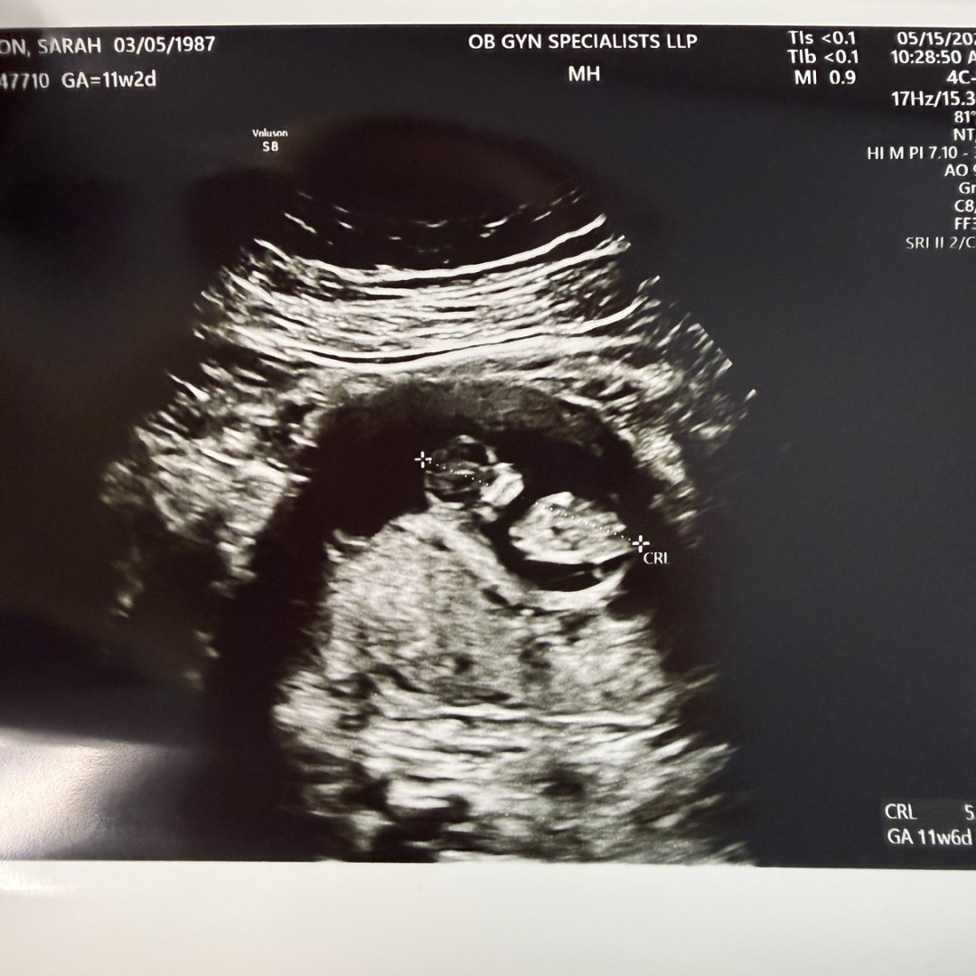 Photo shared by Sarah for their Babylist baby registry.