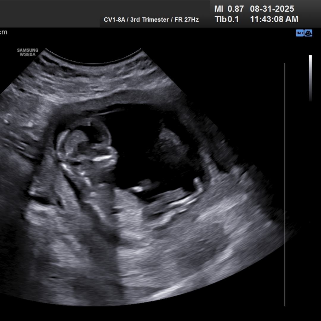 Photo shared by Acie for their Babylist baby registry.