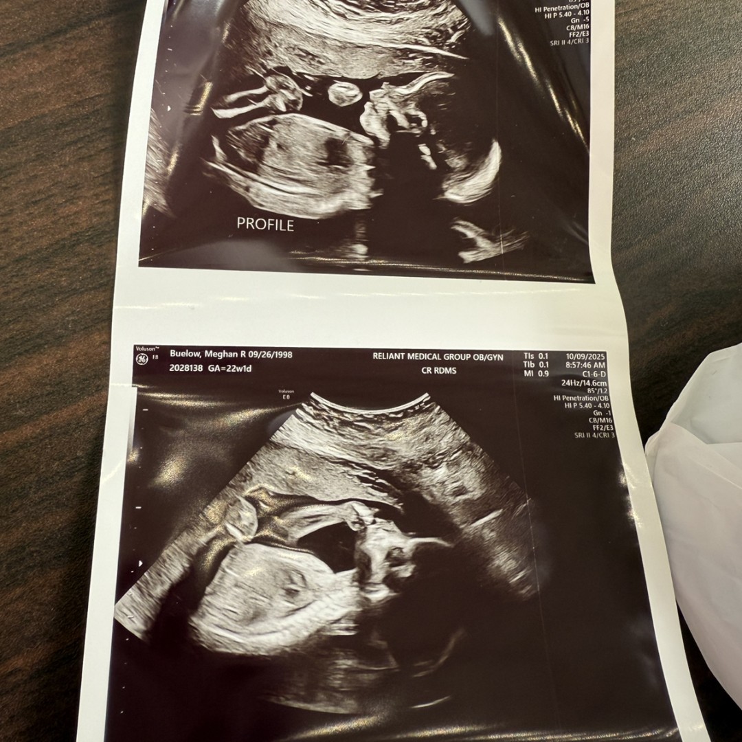 Photo shared by Meghan for their Babylist baby registry.