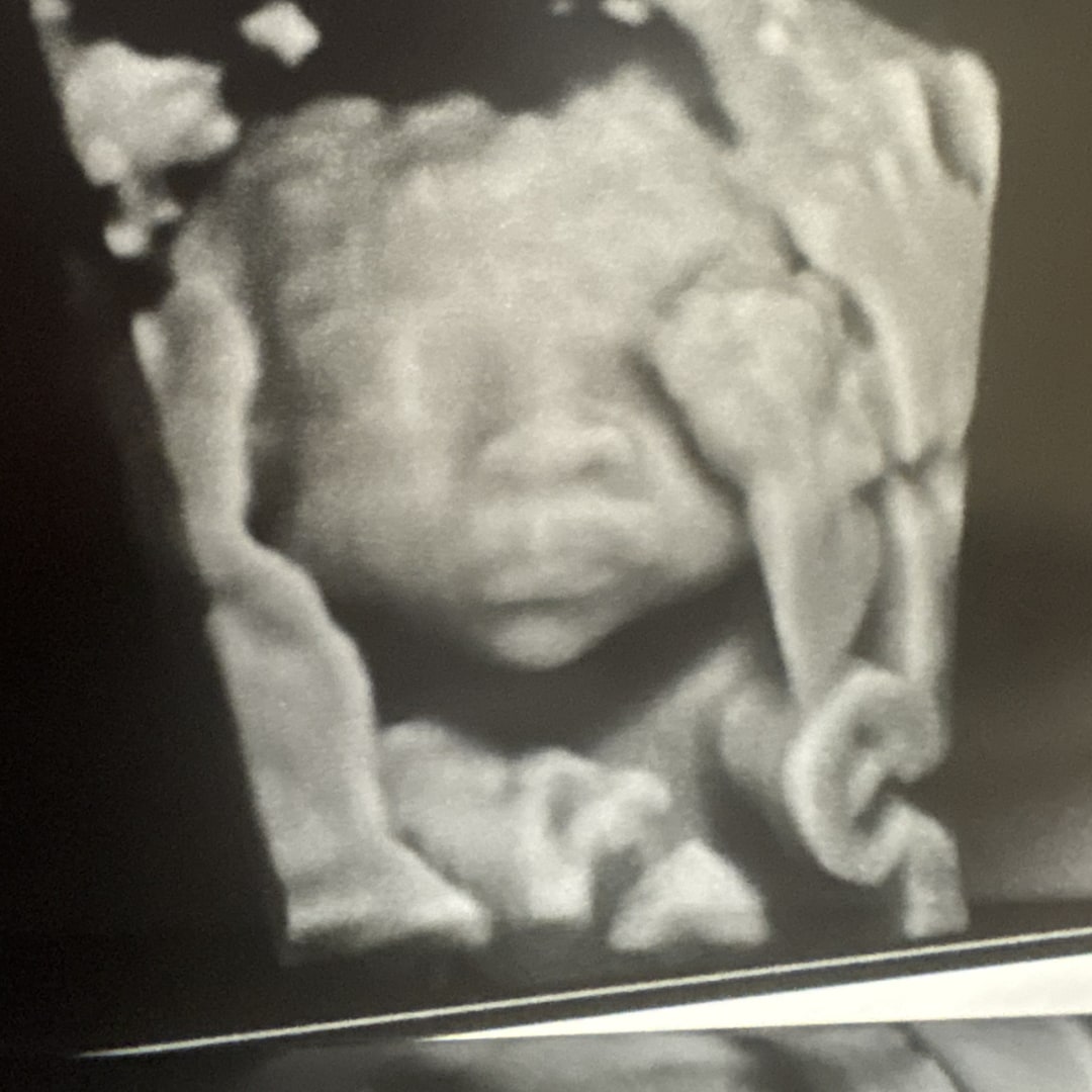 Photo shared by Josselin for their Babylist baby registry.