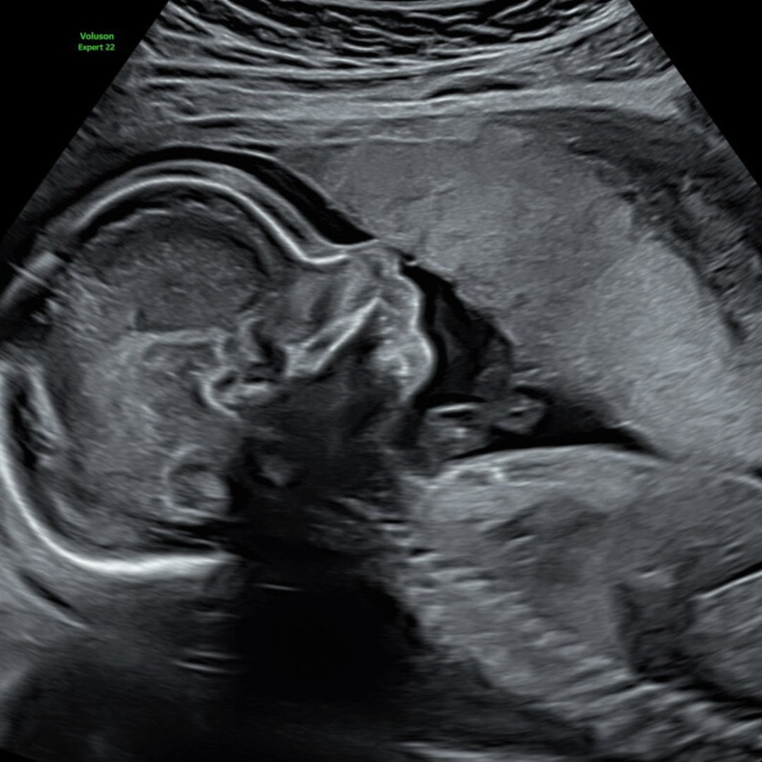 Photo shared by Amanda for their Babylist baby registry.